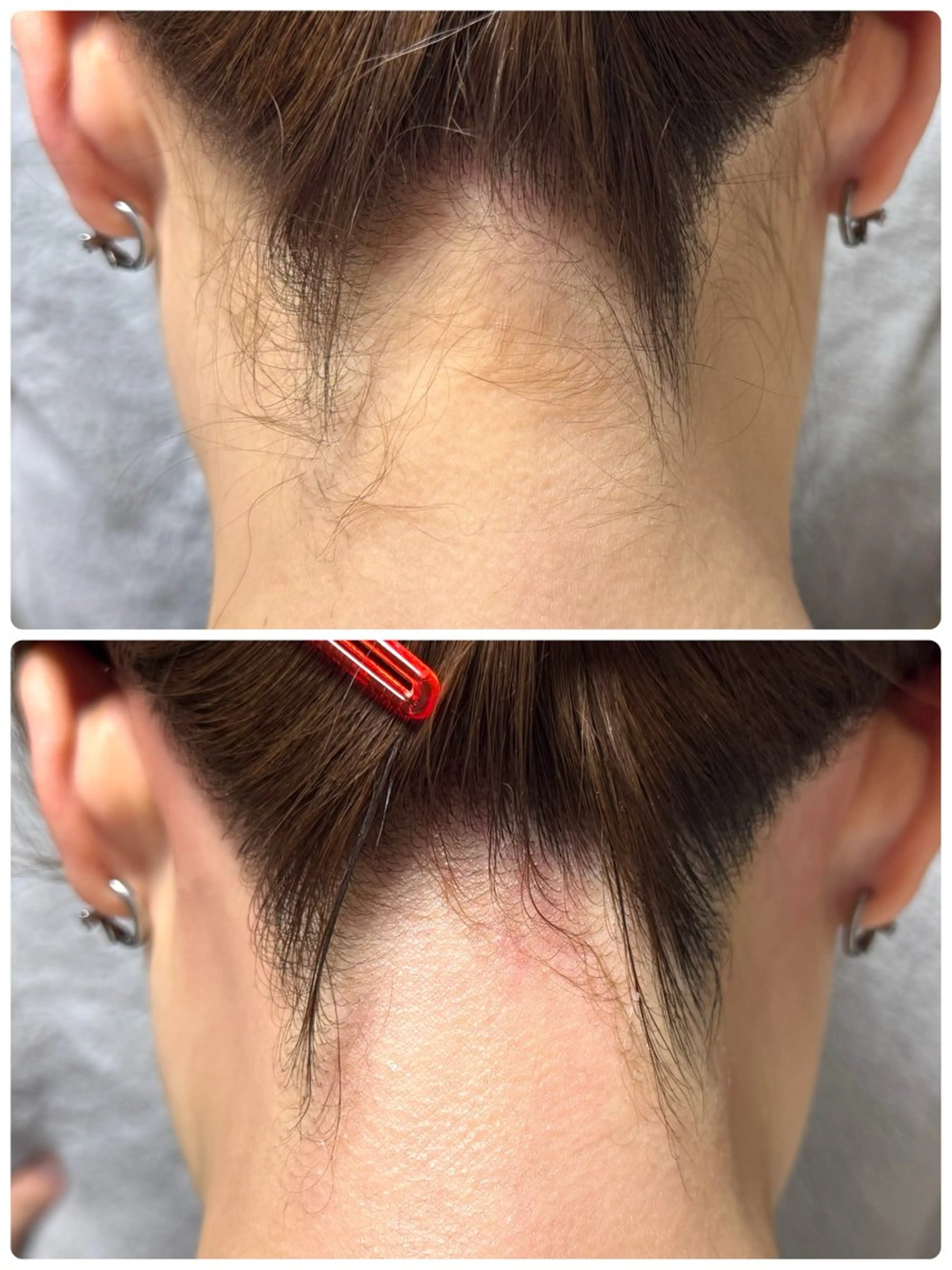 《ミニモ限定価格❤️‍🔥》うなじワックス脱毛🌿 ※注意事項を読んでからご予約下さい♡の写真