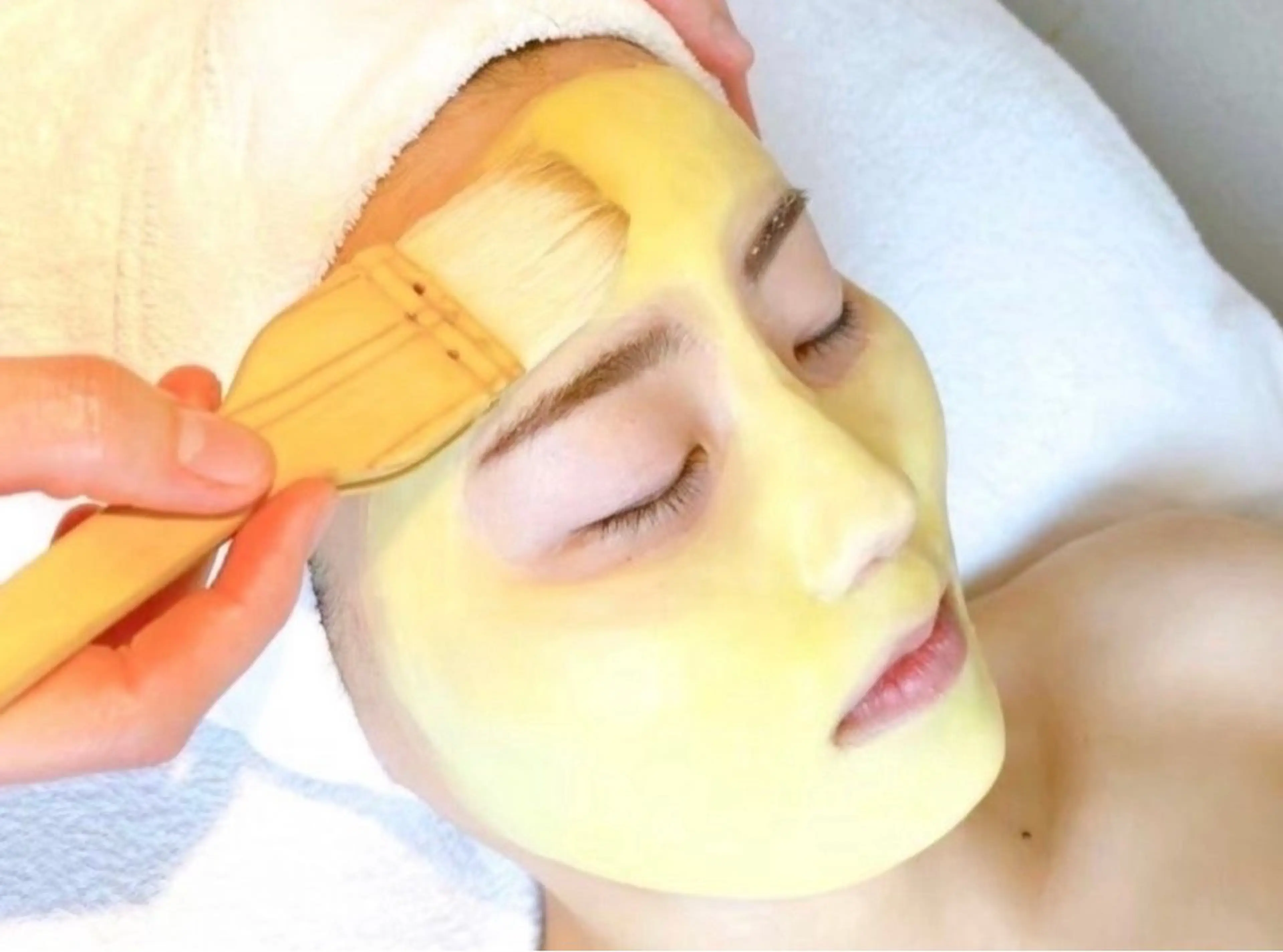 ニキビ、ニキビ跡(美肌蘇生)の写真