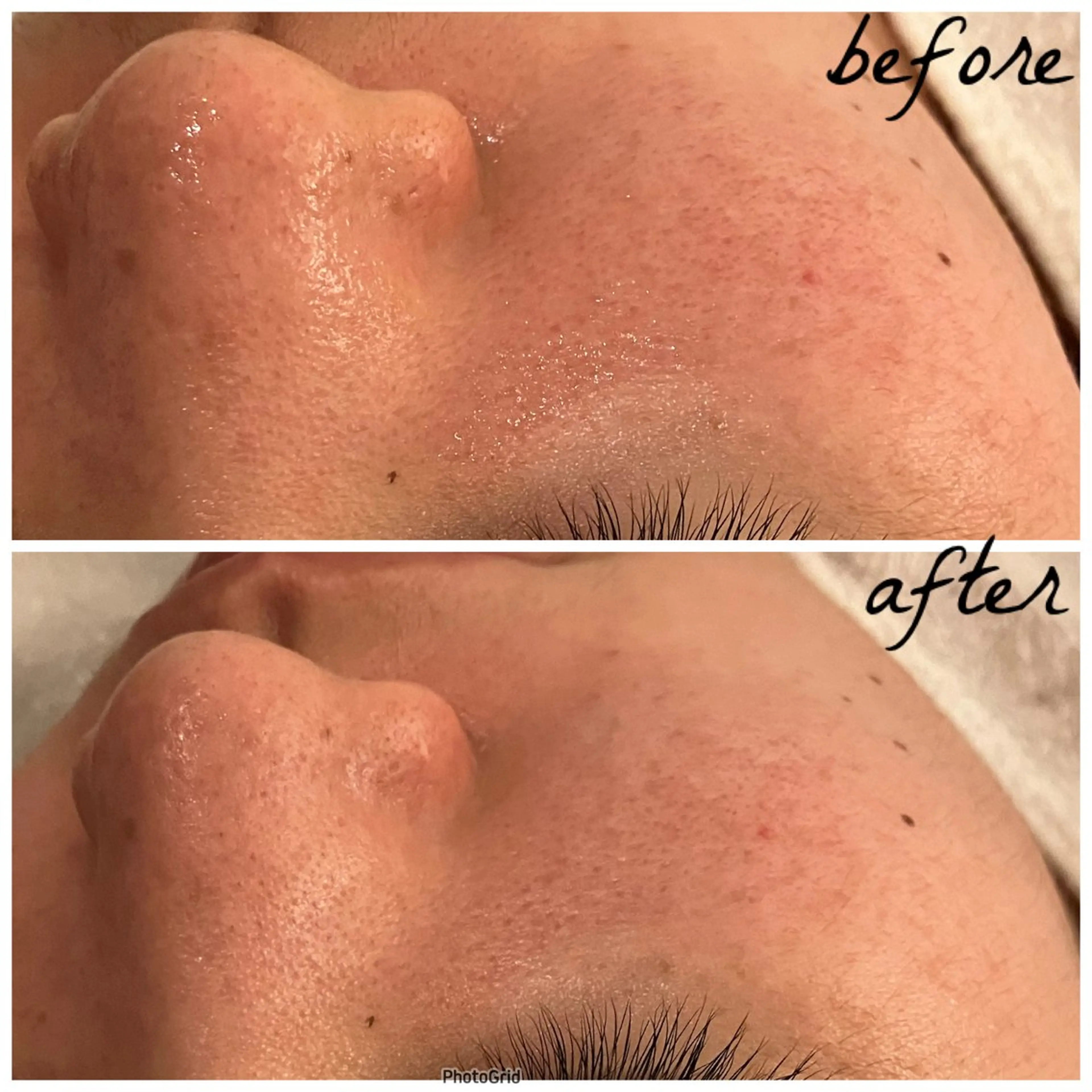 メンズ エステ メナード岐阜茜部 杉浦のエステ・リラクイメージ