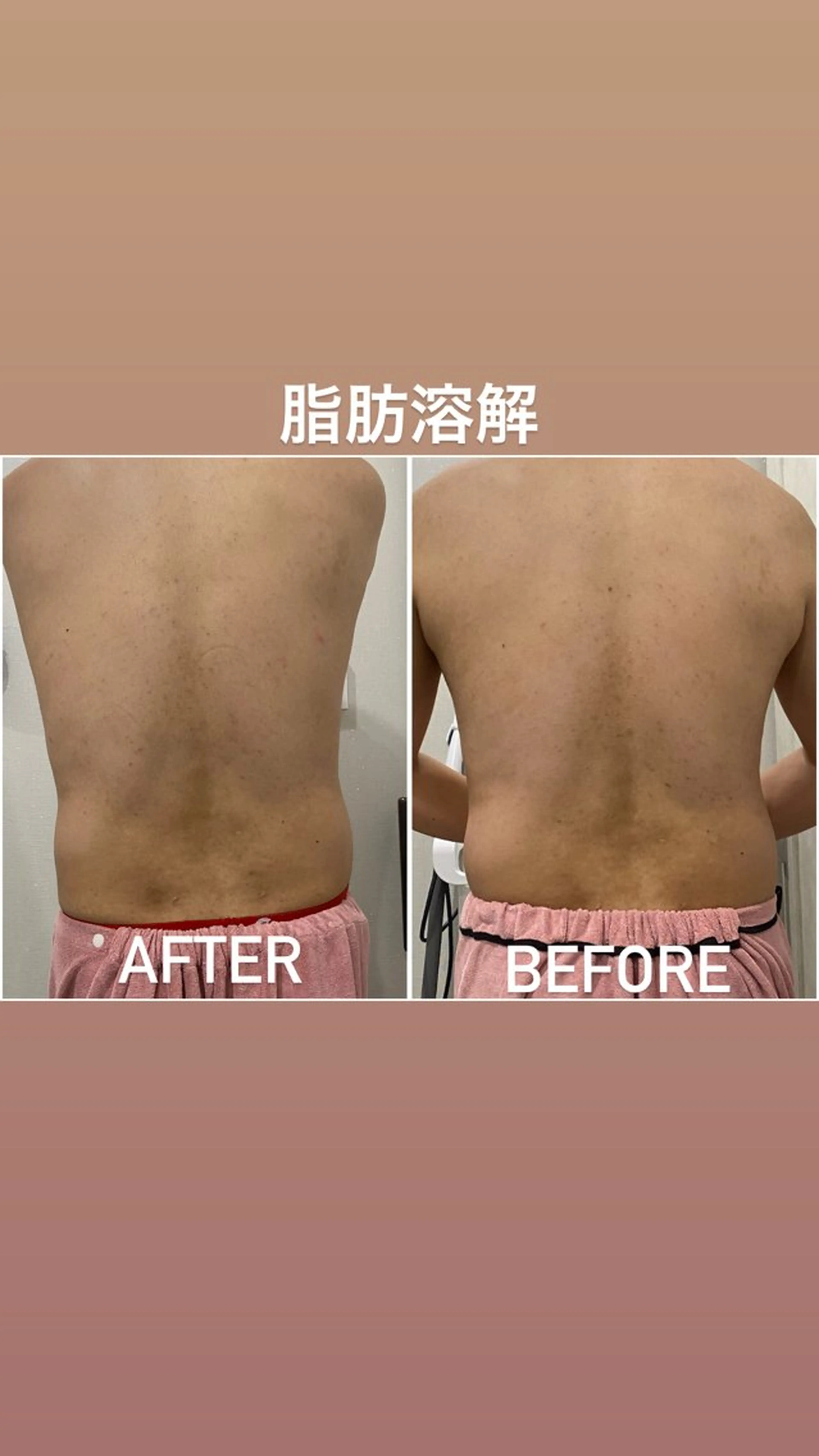 エステ 毛穴洗浄・痩身・脱毛 /アルカンジュのエステ・リラクイメージ