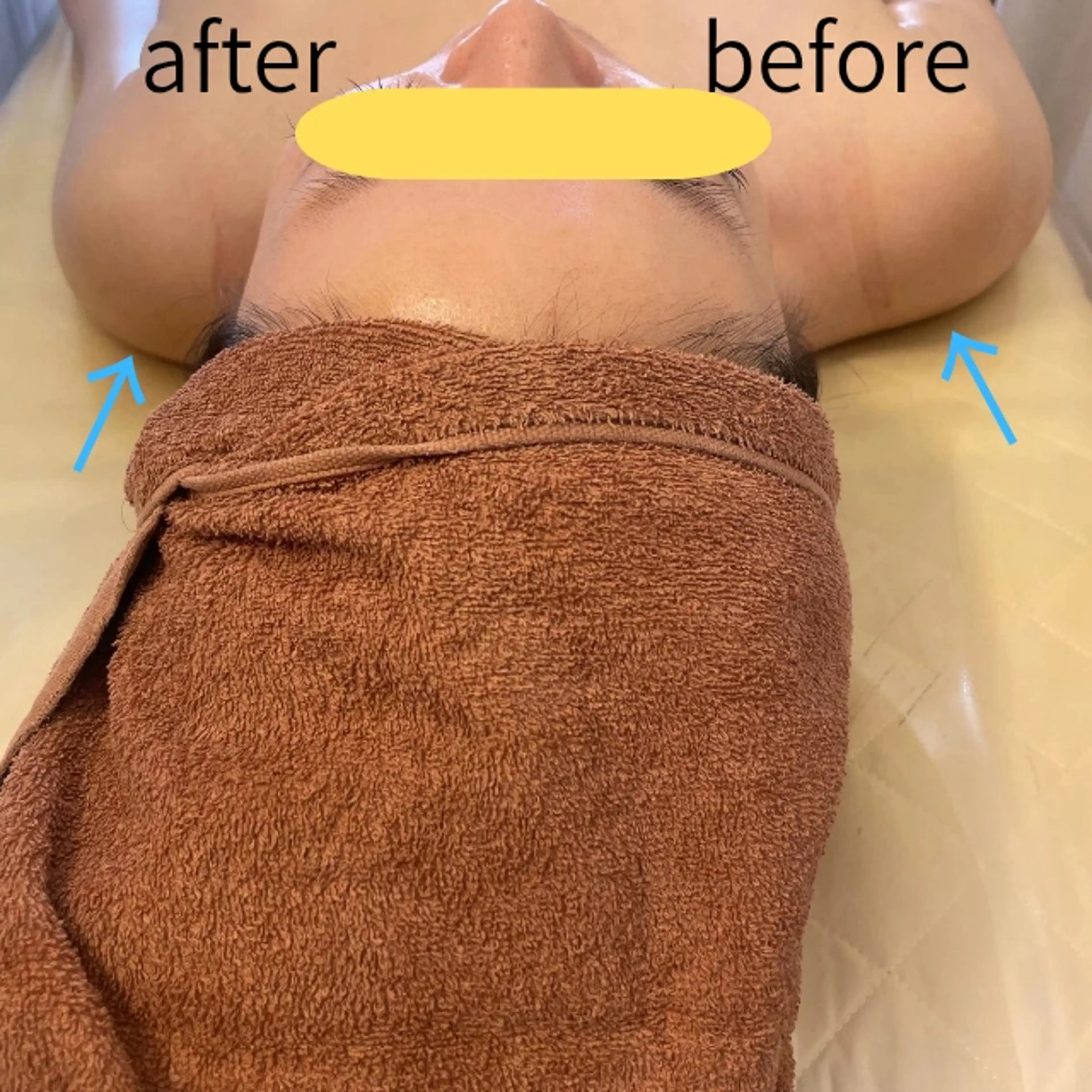 エステ aliaハイフ&水光ジェットサロン所属・aliaハーブ水光店 エステティシャン募集のエステ・リラクイメージ