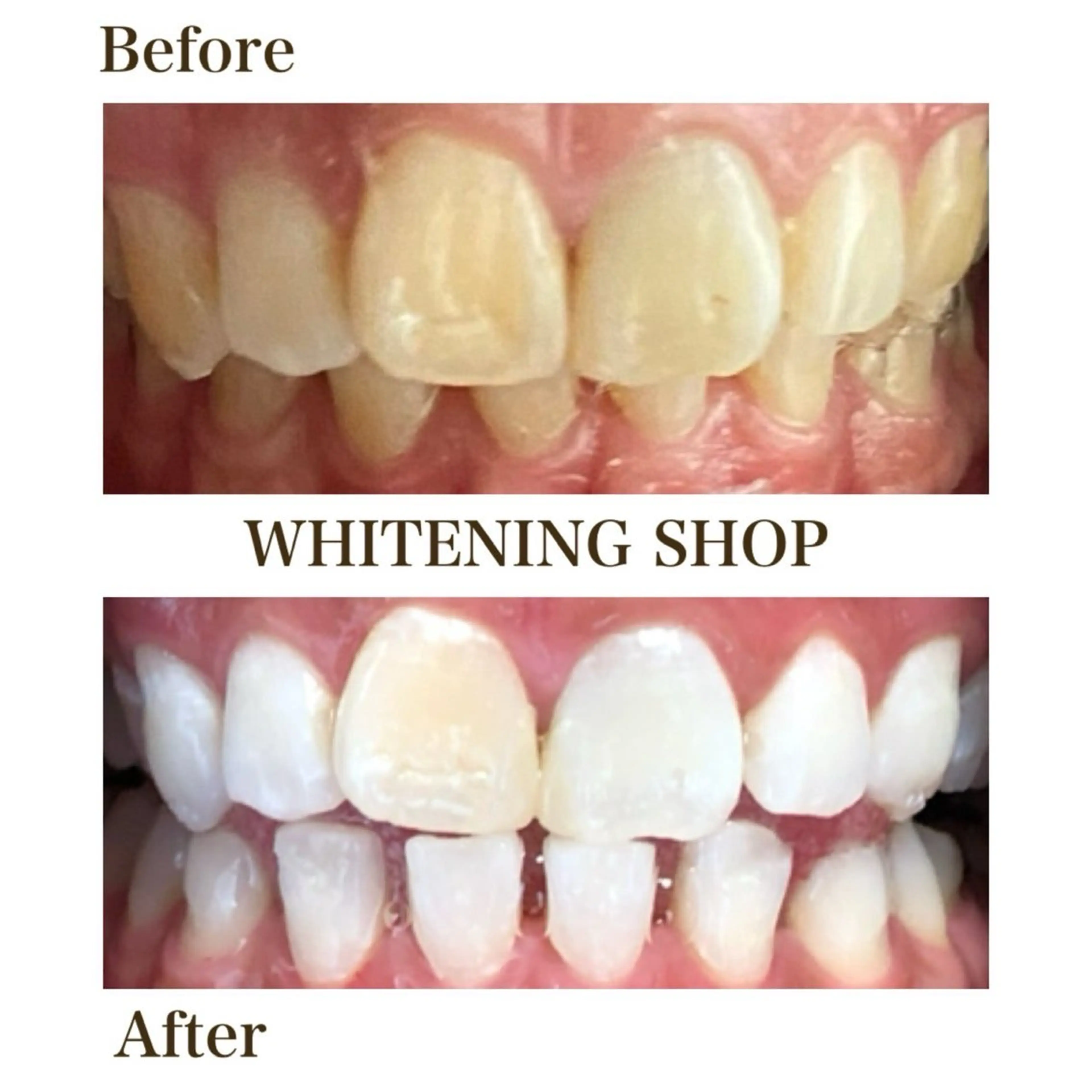 その他 ホワイトニングショップ静岡葵区店所属・ホワイトニング ショップ葵区静岡駅店のその他イメージ