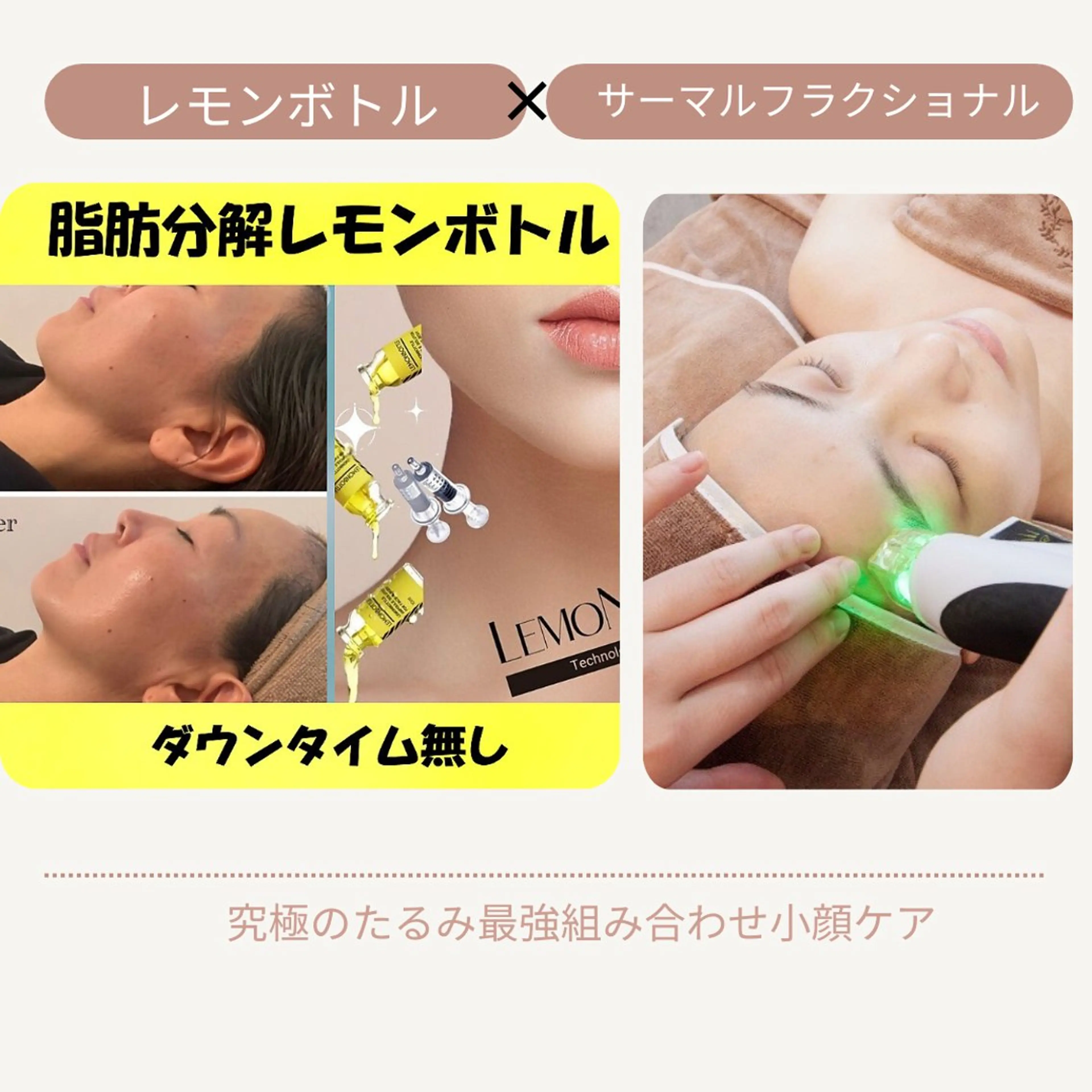 【新規限定】韓国🇰🇷🍋ボトル×RFサーマルフラクショナル/小顔ケアの写真