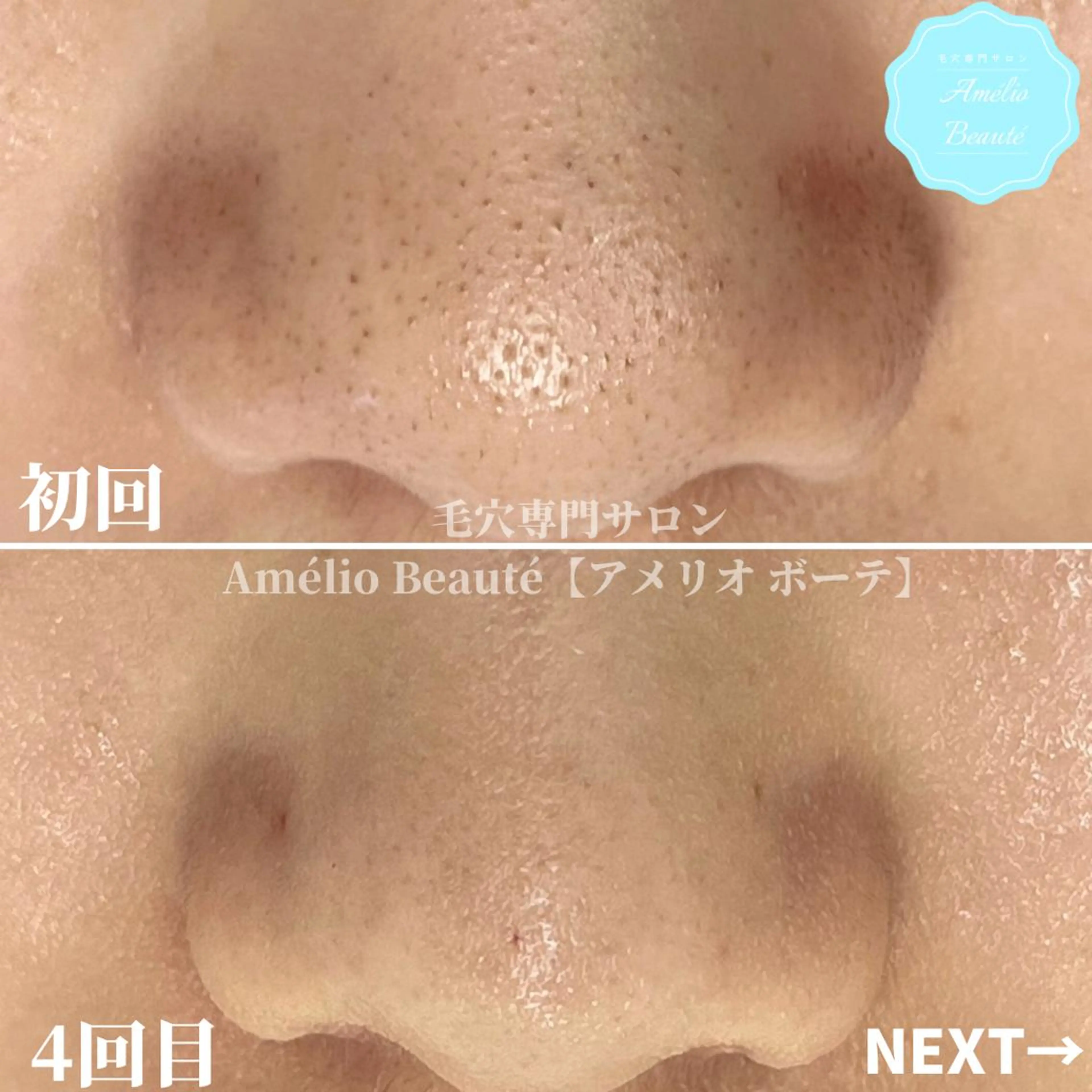毛穴ケア専門サロン Amélio Beauté所属・毛穴ケア専門サロン アメリオボーテのその他イメージ