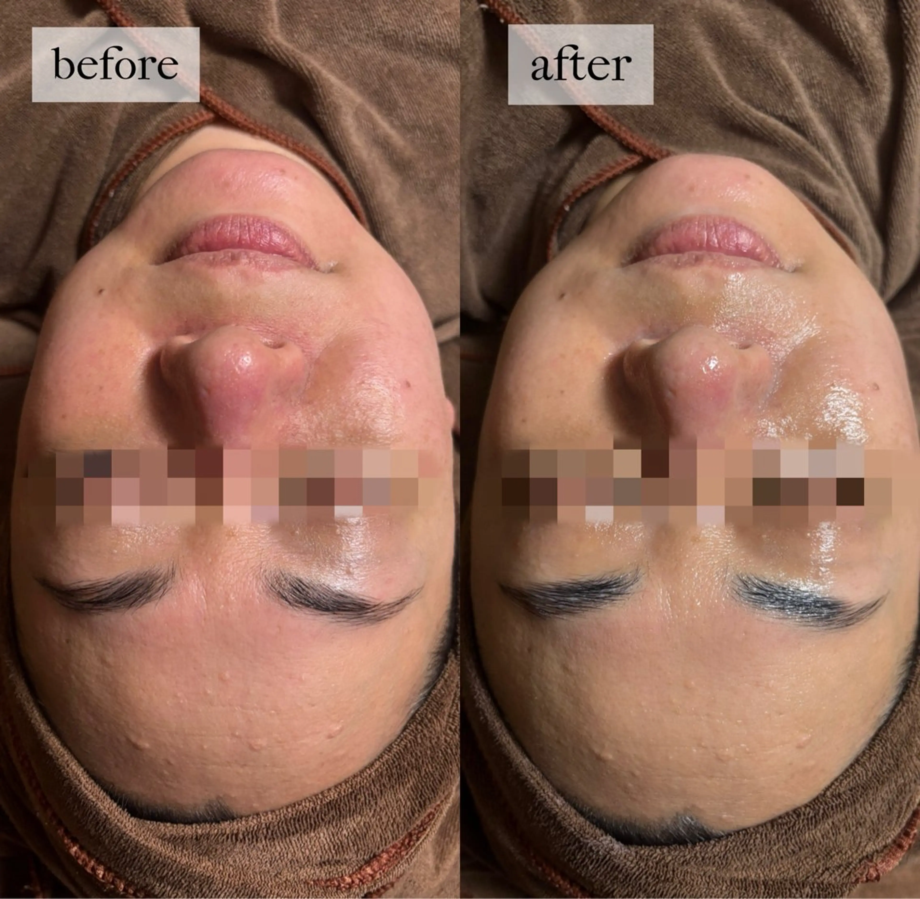 エステ HINANO矢場町店【ヒナノ】所属・脱毛/肌改善🌿 HINANO 村田のエステ・リラクイメージ