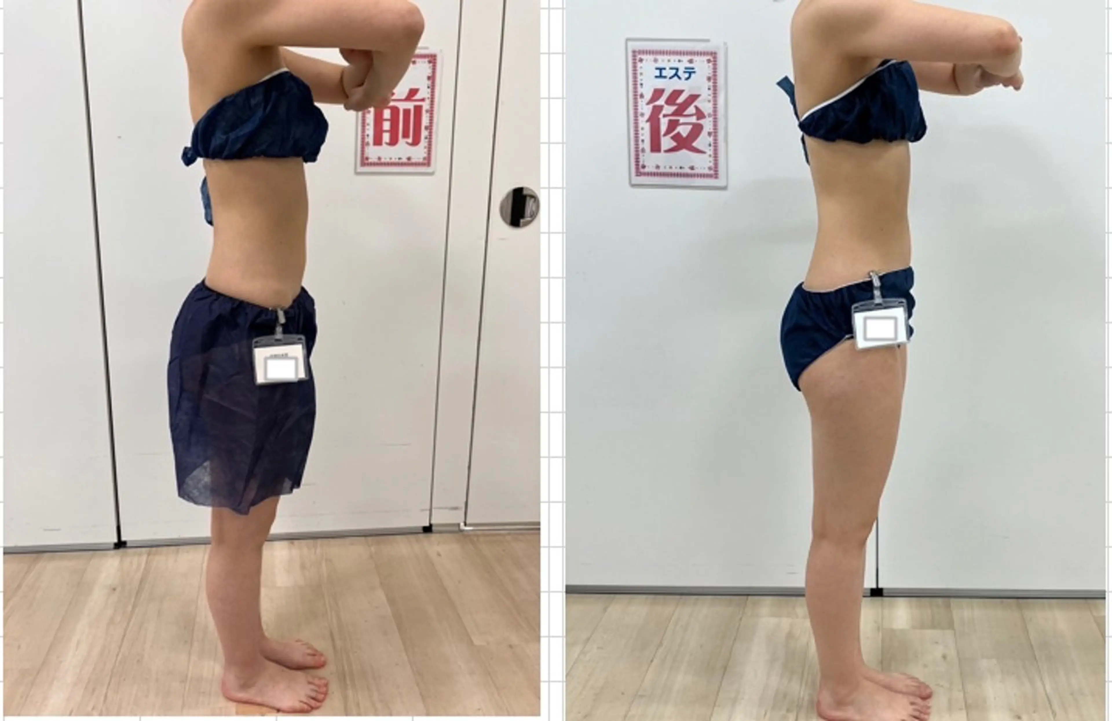 10月末まで！痩身エステ(ウエスト、背中スッキ!)の写真