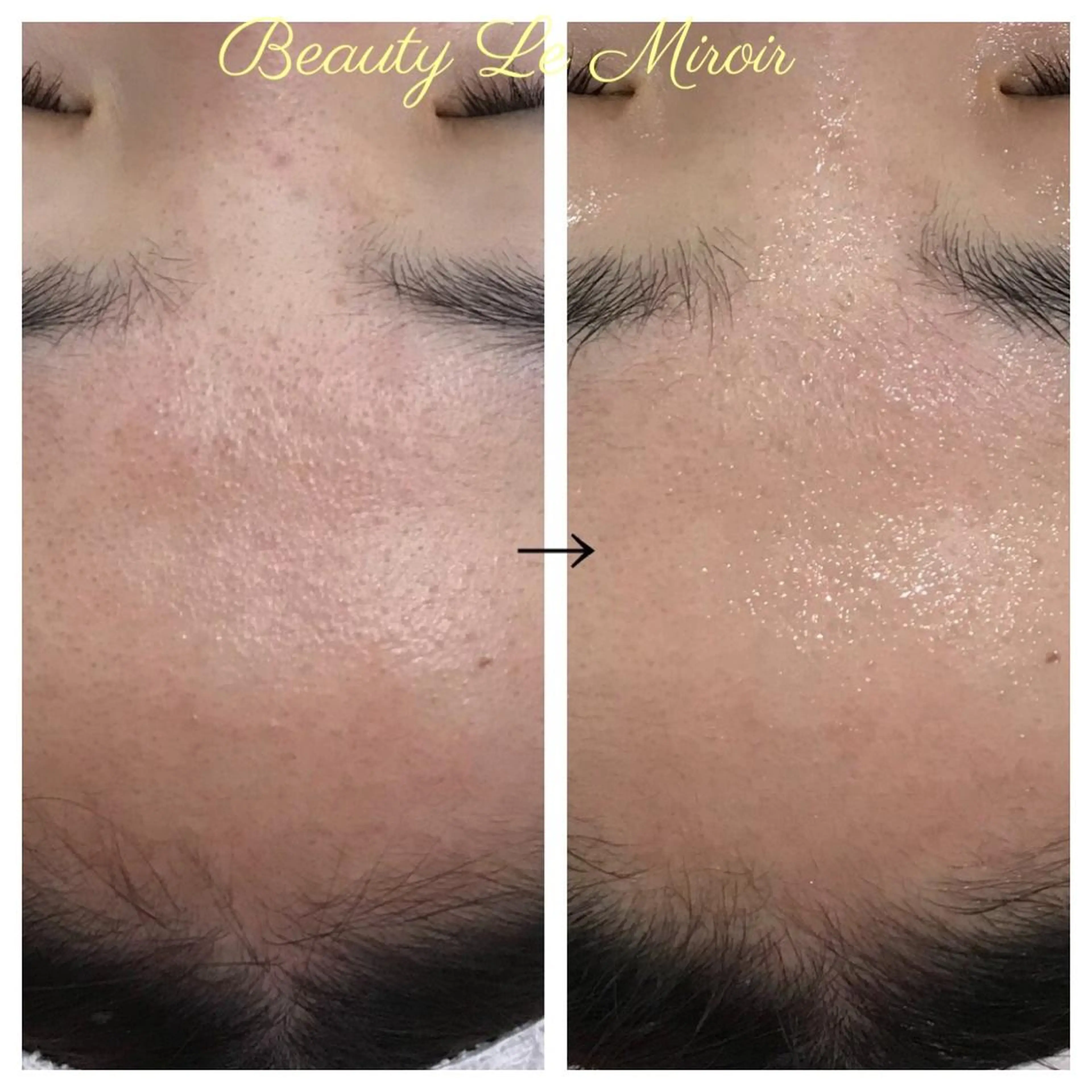 ビューティー ミロワールのエステ・リラクイメージ