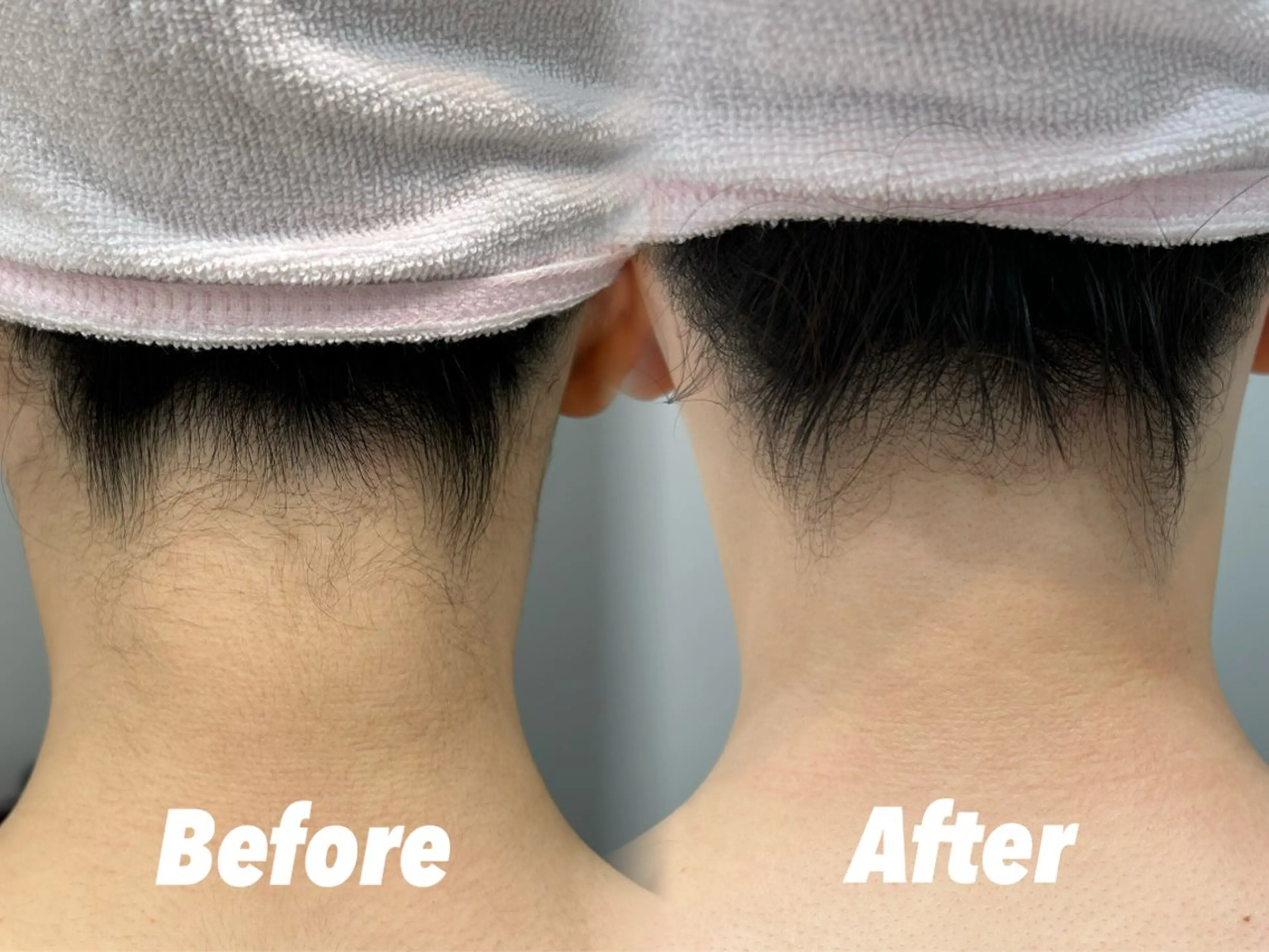 エステ リラク 🫧美しい素肌へ🫧 今成柚乃のその他イメージ