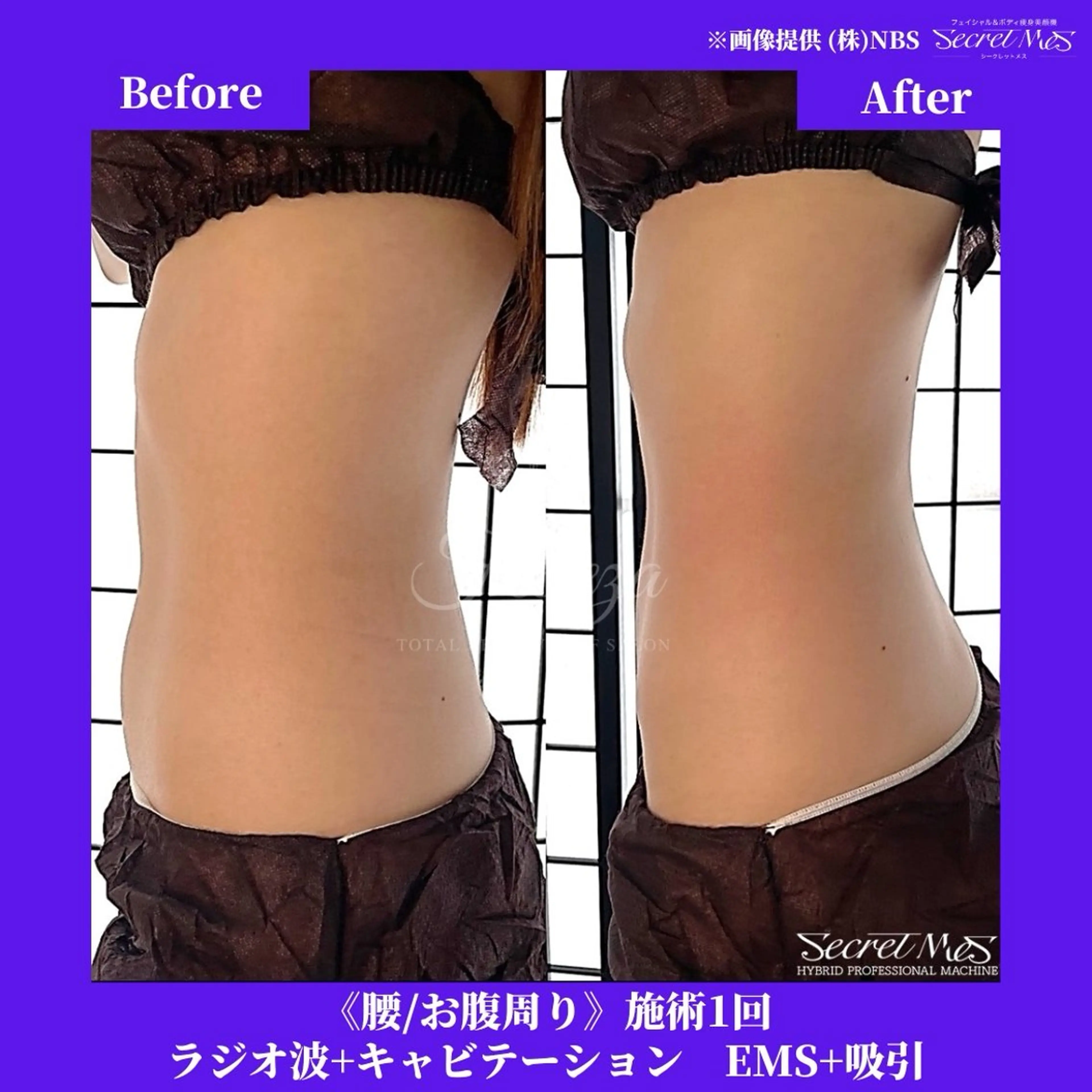 メンズ 有人型セルフサロン 脱毛／痩身／美顔のその他イメージ