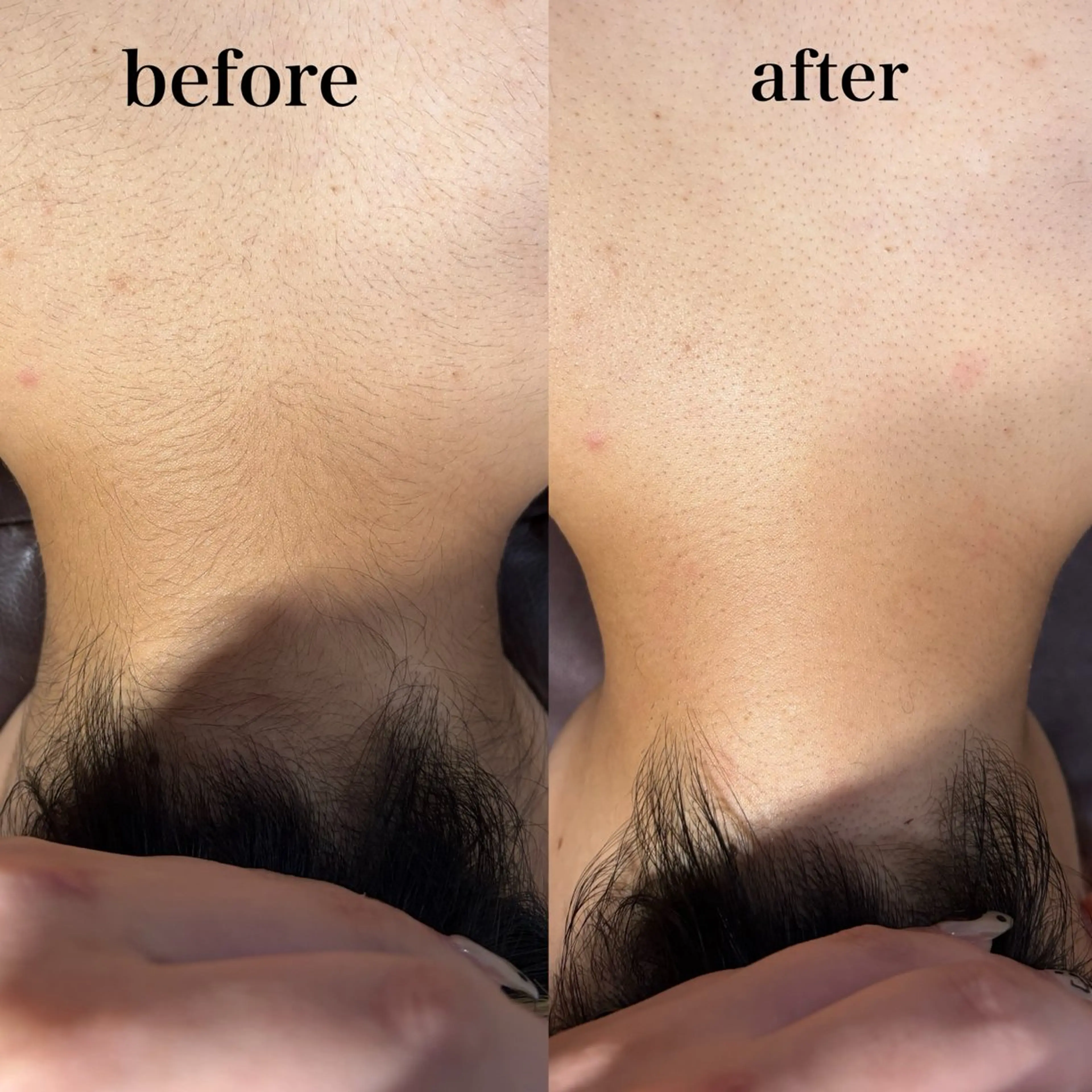 その他 Mr.&Ms.脱毛 /眉毛/りかこのエステ・リラクイメージ