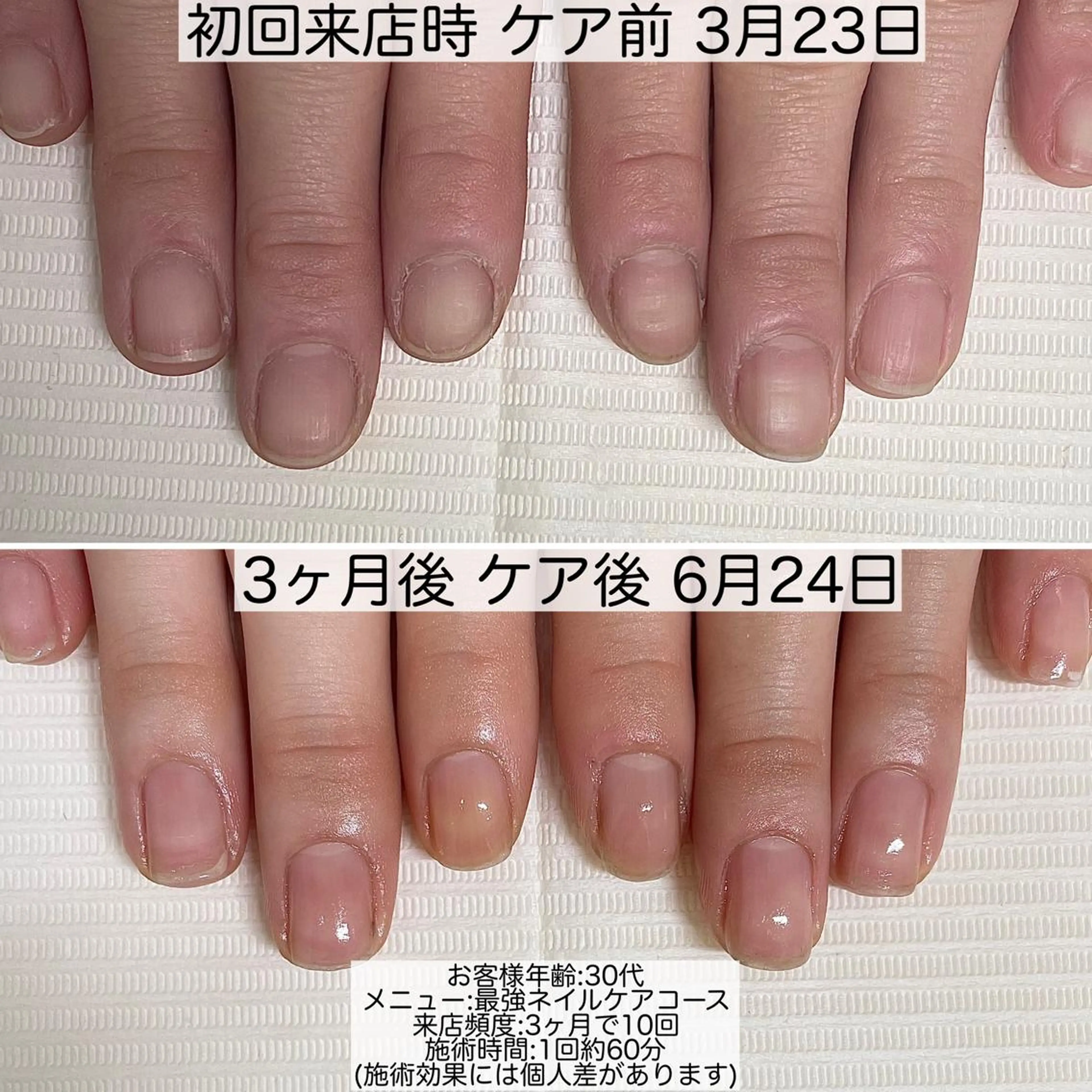 ネイル ジェルネイル nailsalon noa所属・nailist sakiのネイルデザイン
