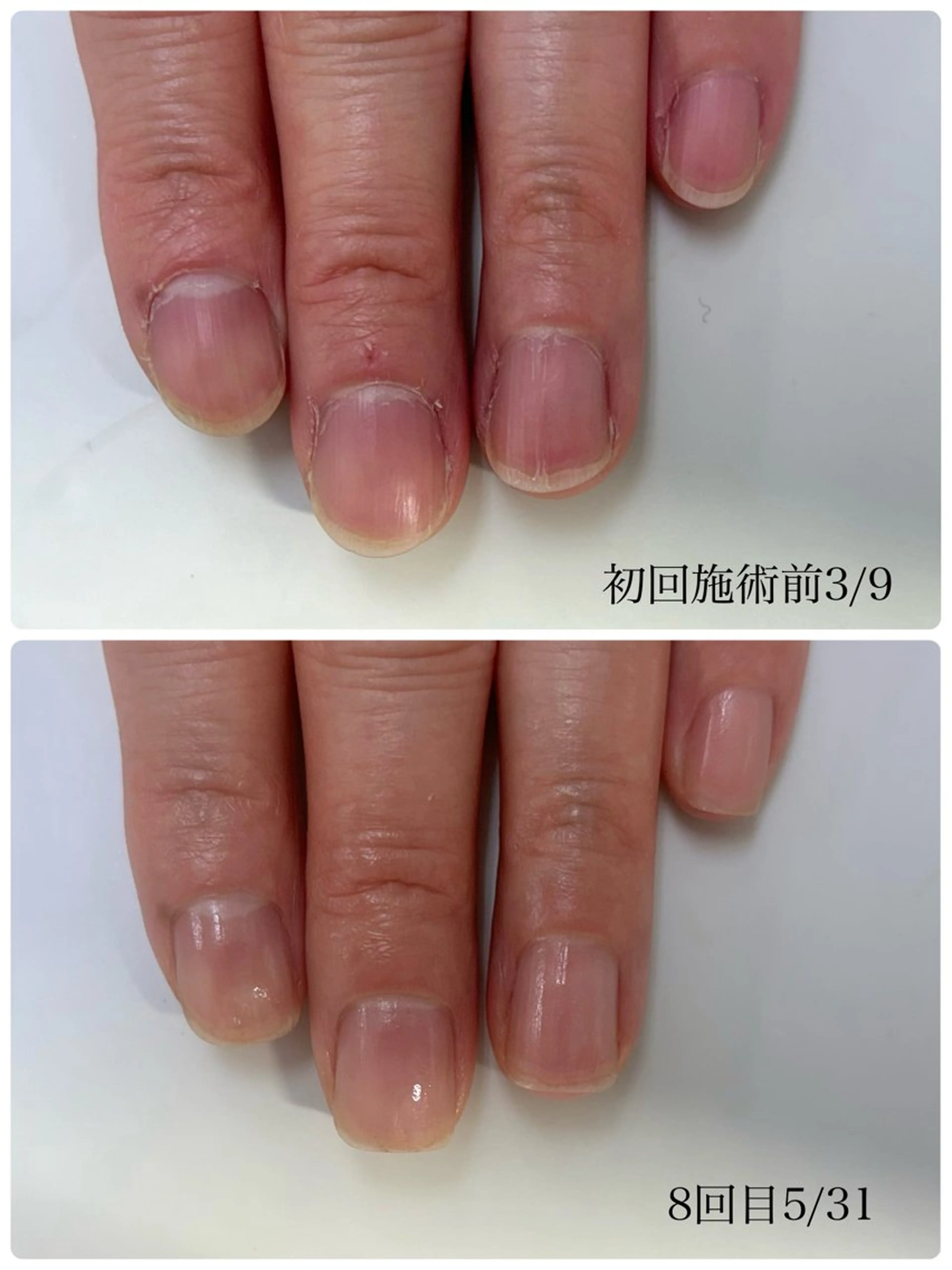 ネイル TiALASH ＊Kozue＊のネイルデザイン