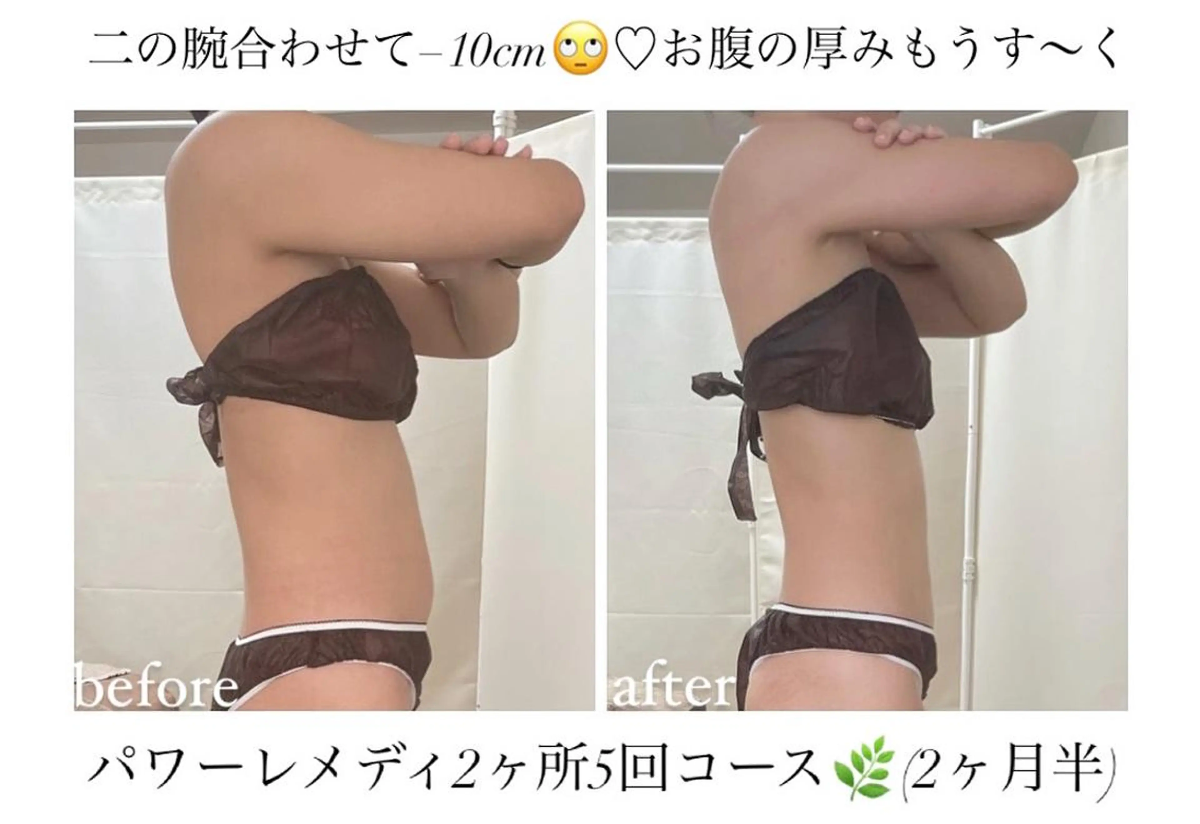 biloop所属・《本気痩せ×疲労改善 》  BILOOPのエステ・リラクイメージ