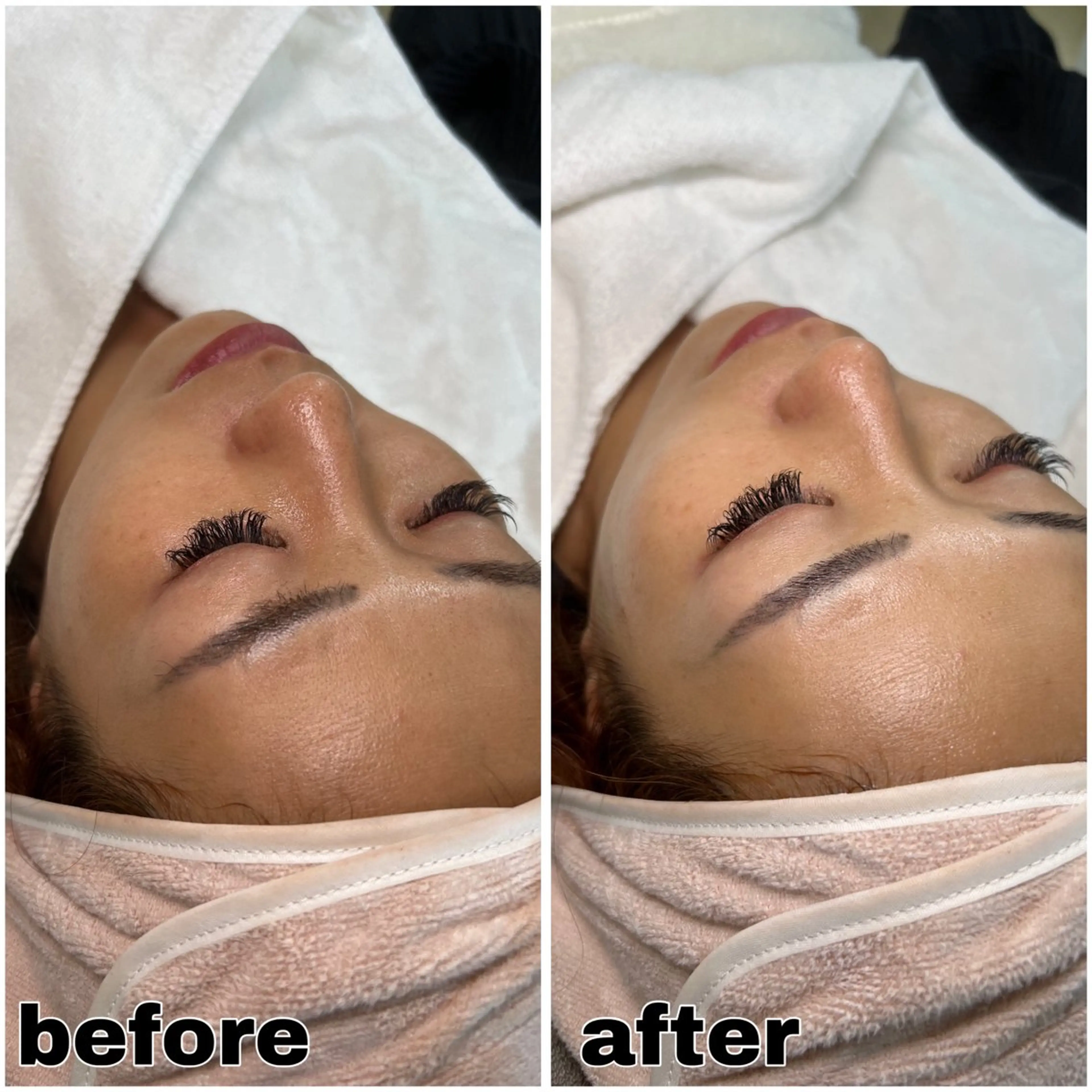 【モニター募集】お試しシェービングの写真