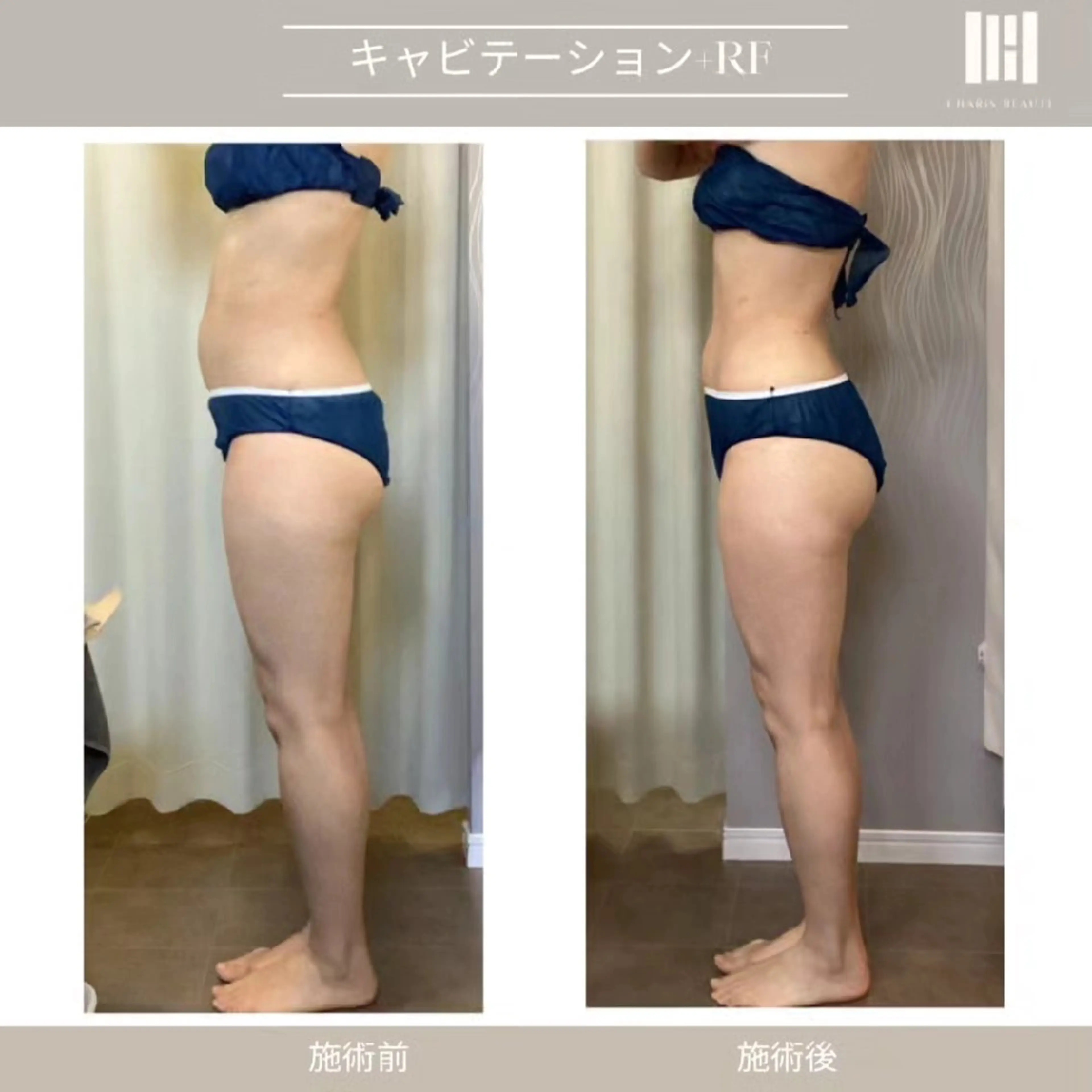 エステ 上杉 彩のエステ・リラクイメージ