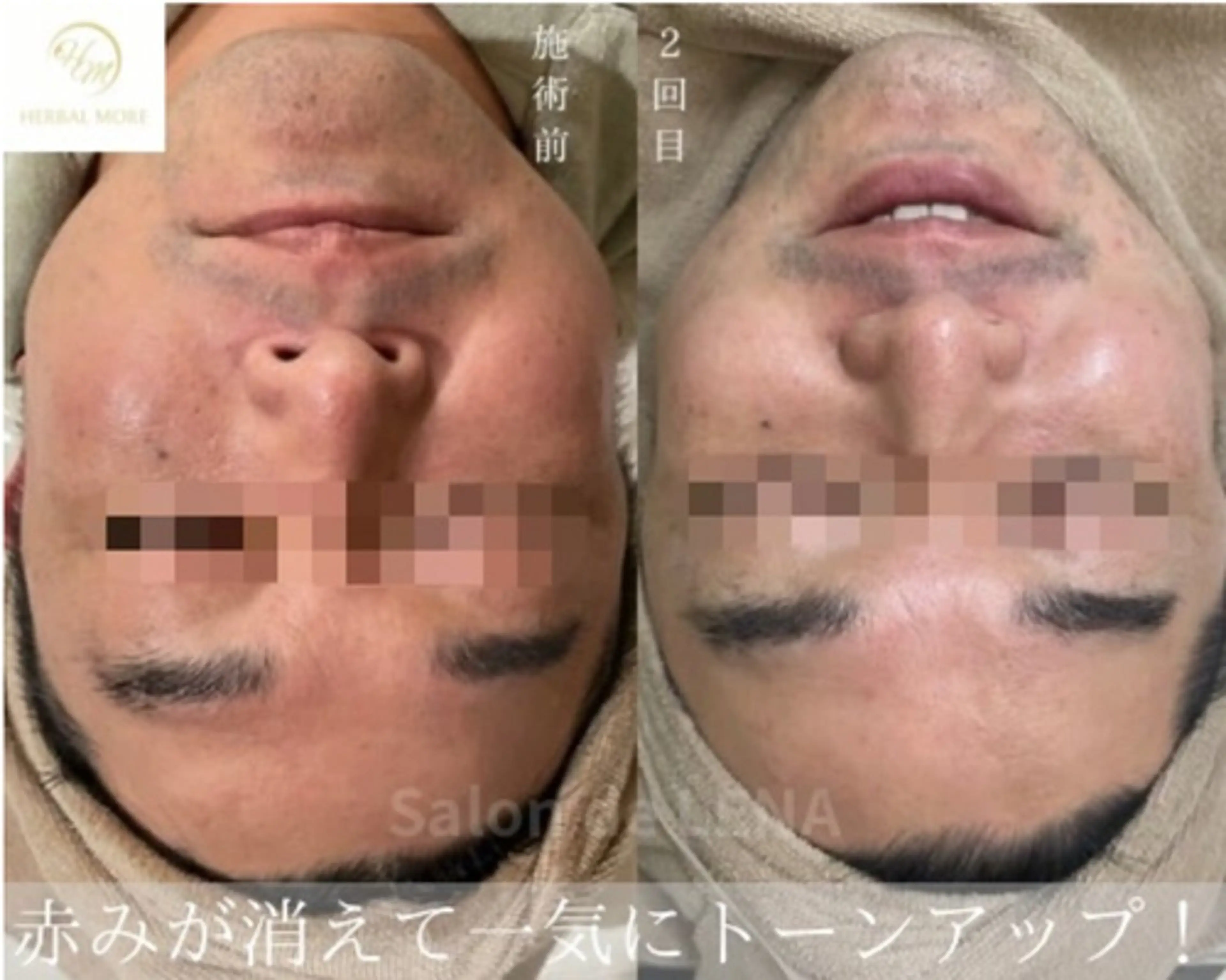 エステ サロンドレナ名駅店所属・ハーブピーリング専門 サロンドレナ平岡のエステ・リラクイメージ