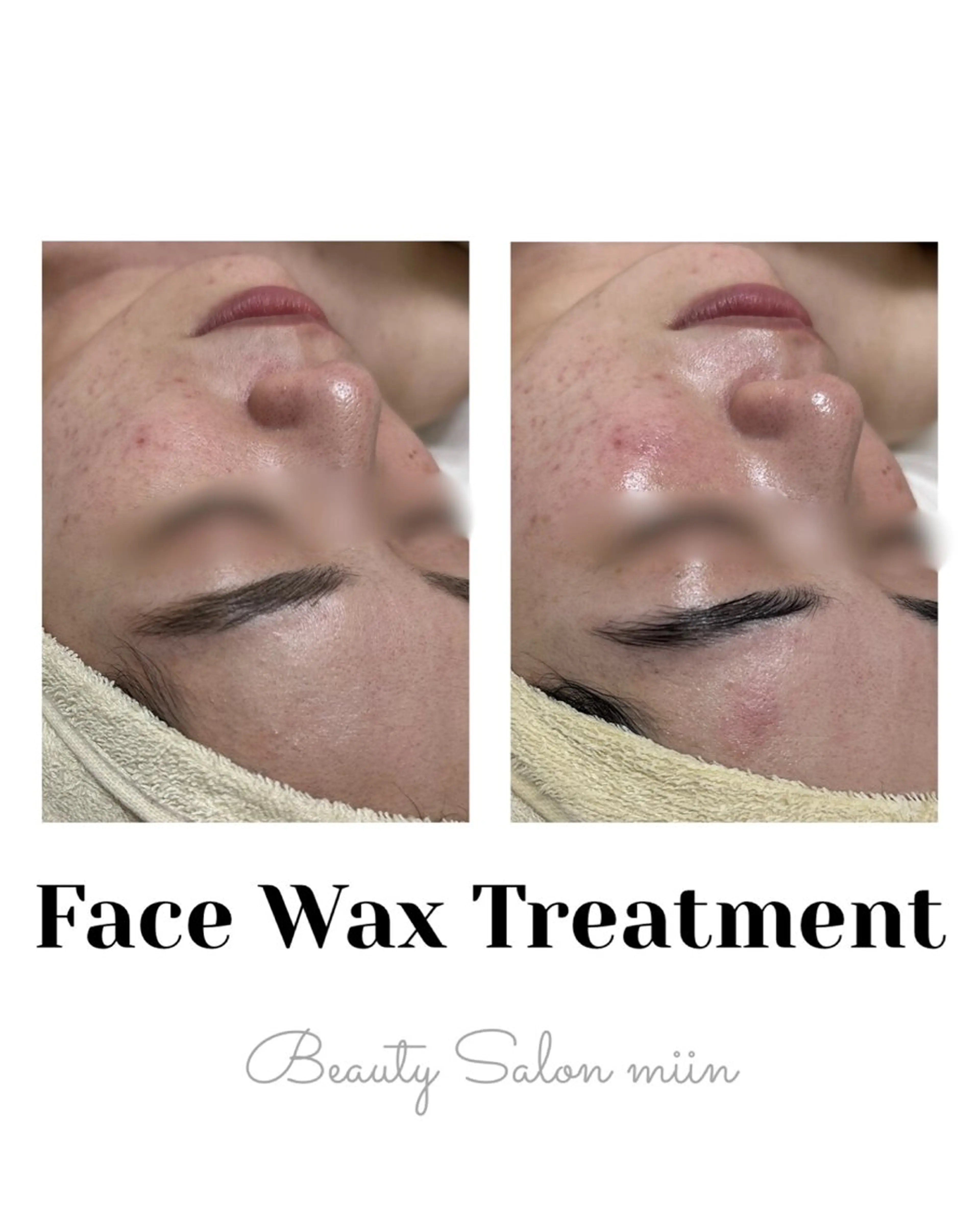 リラク 韓国肌管理 白玉肌管理®︎のエステ・リラクイメージ