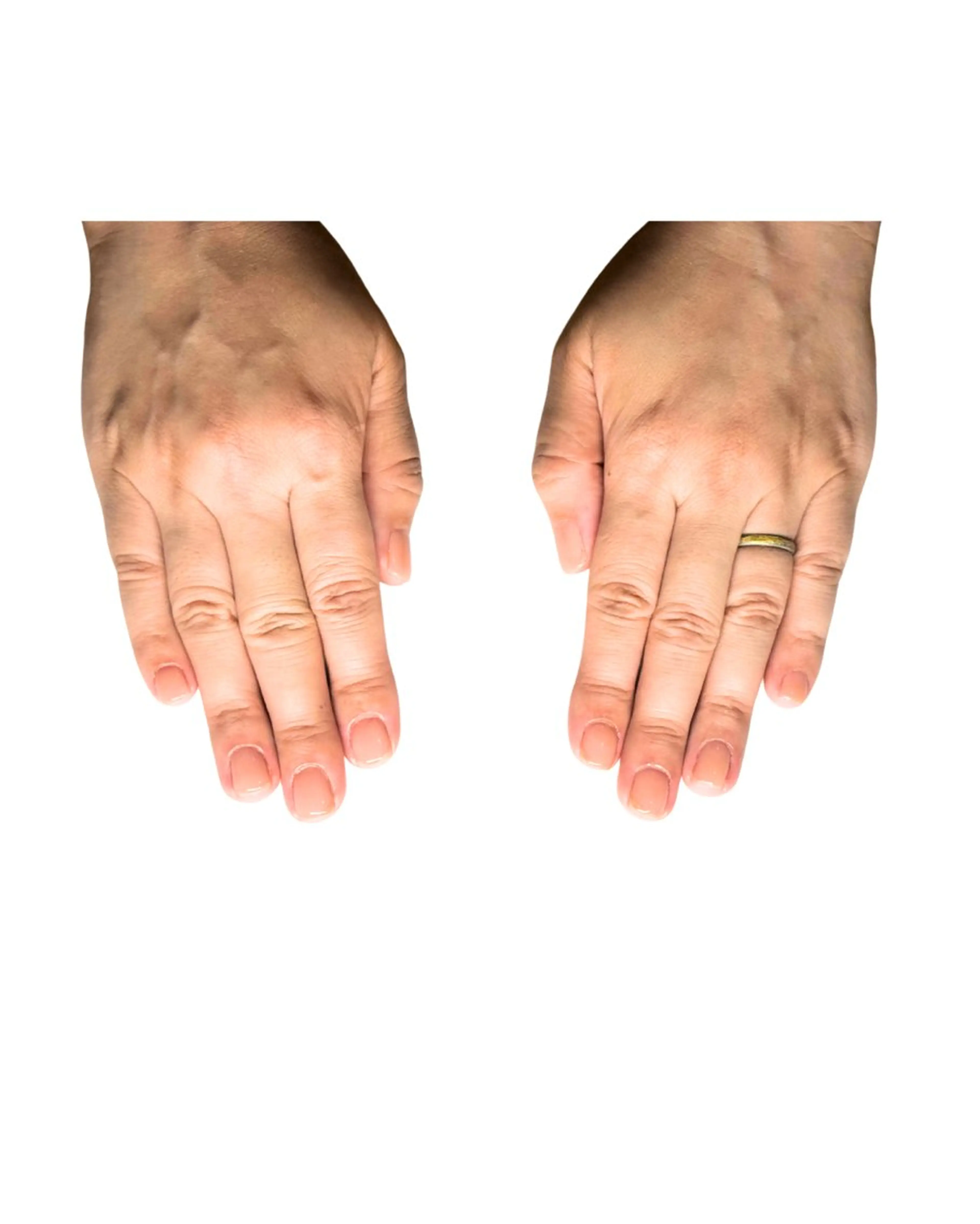 ネイル ワンカラーネイル 深爪矯正専門店ネイルサロンKUU所属・ネイルサロン KUUのネイルデザイン