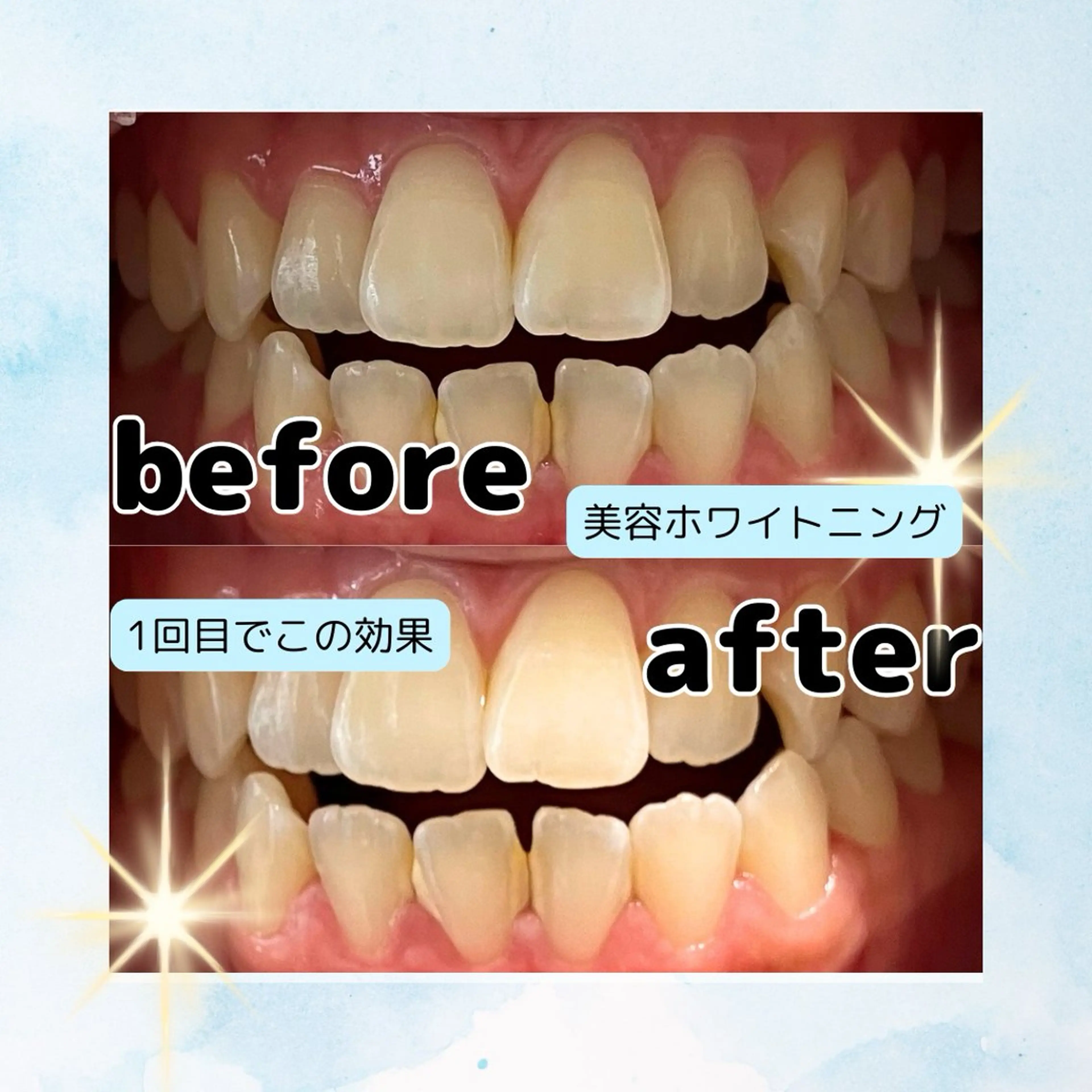 ホワイトニングサロン Soleilのその他イメージ