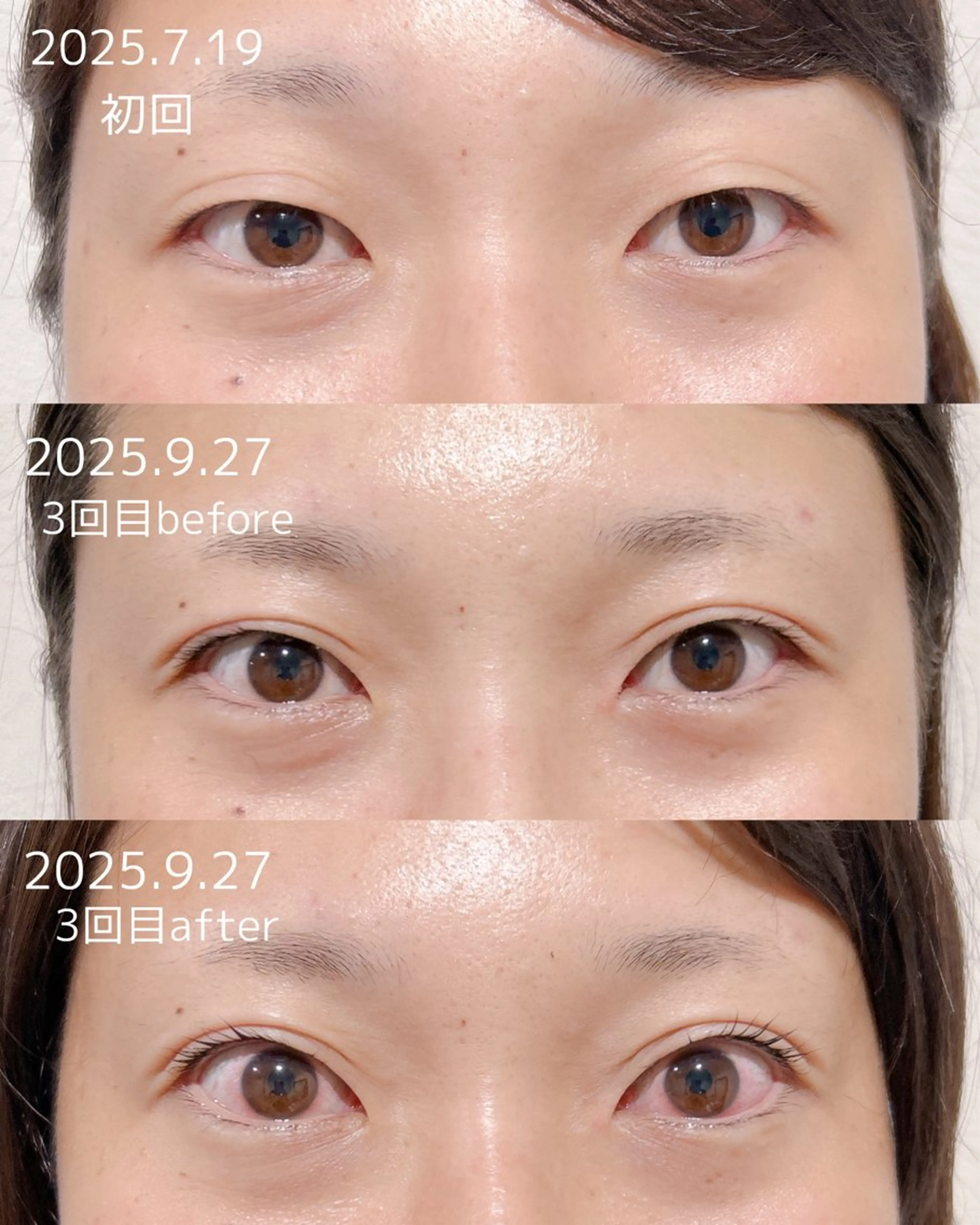 マツエク・マツパ アイリッドアップパーマ 一重×まつ毛パーマ マツパ merveilles所属・まつげ/整体/にきび ・アトピー専門サロンのマツエク・マツパデザイン