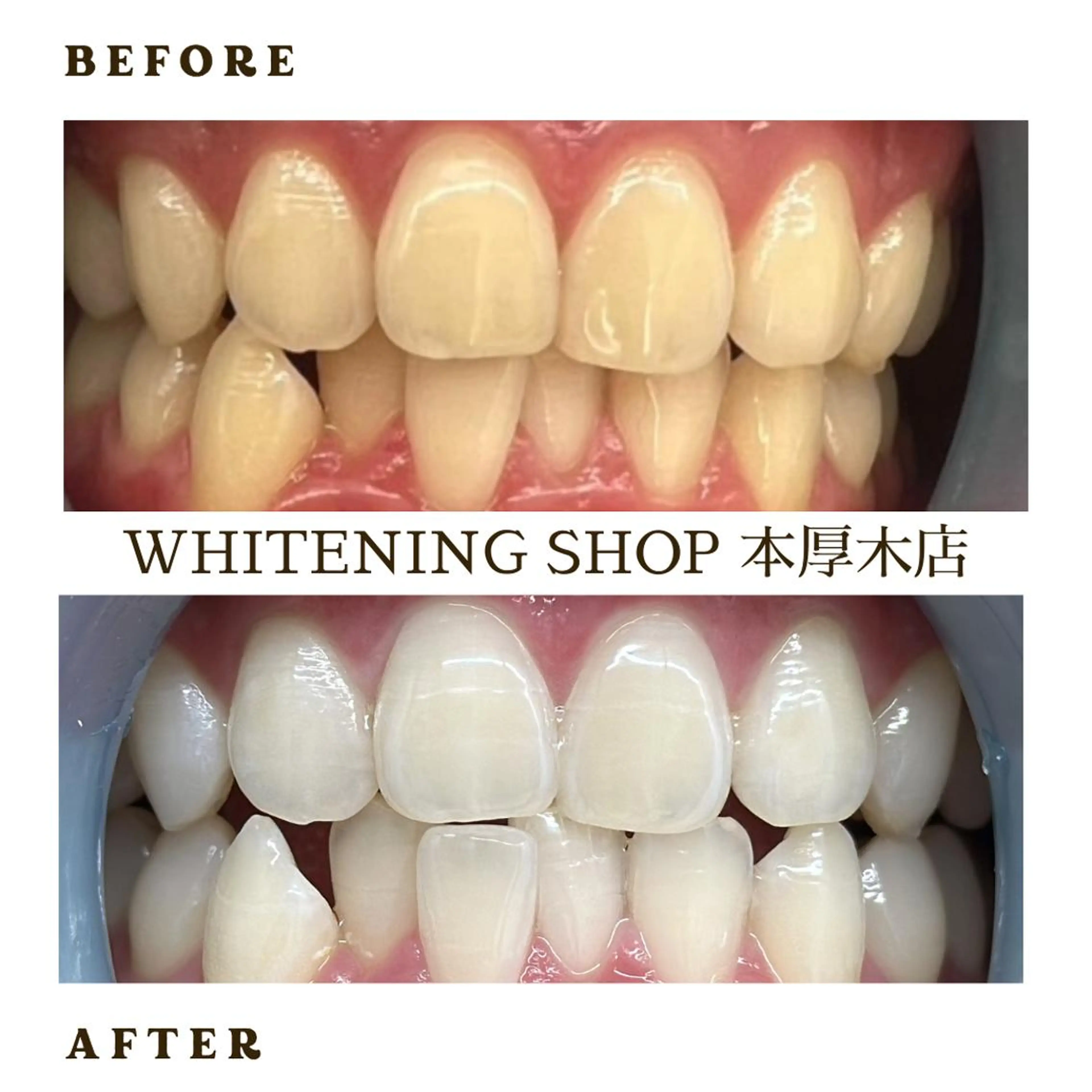 メンズ その他 ホワイトニング ショップ本厚木のその他イメージ