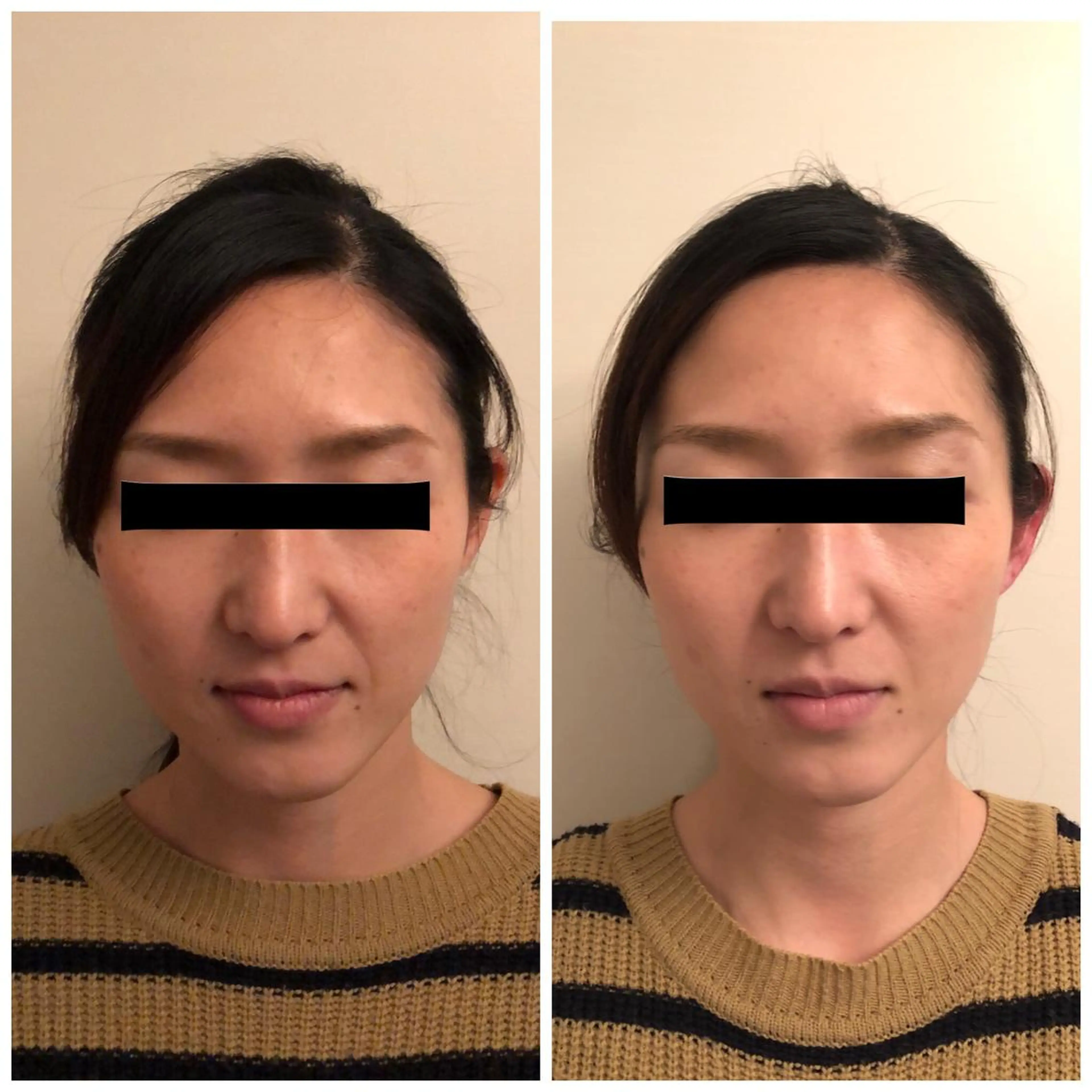 エステ リラク おうちサロン B-ROOMのエステ・リラクイメージ