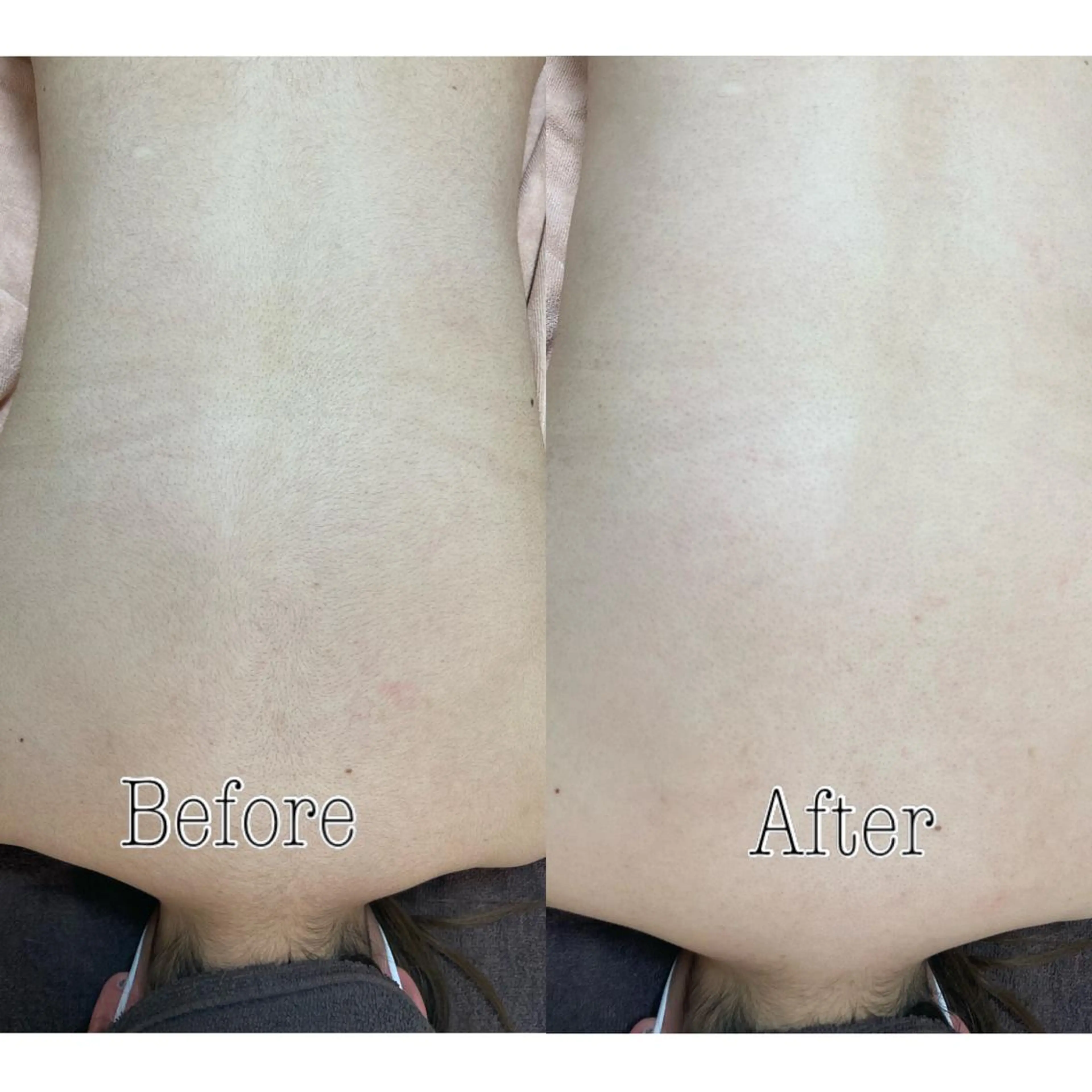 都度払い制脱毛サロンBe Charm所属・Be Charm 山﨑のエステ・リラクイメージ