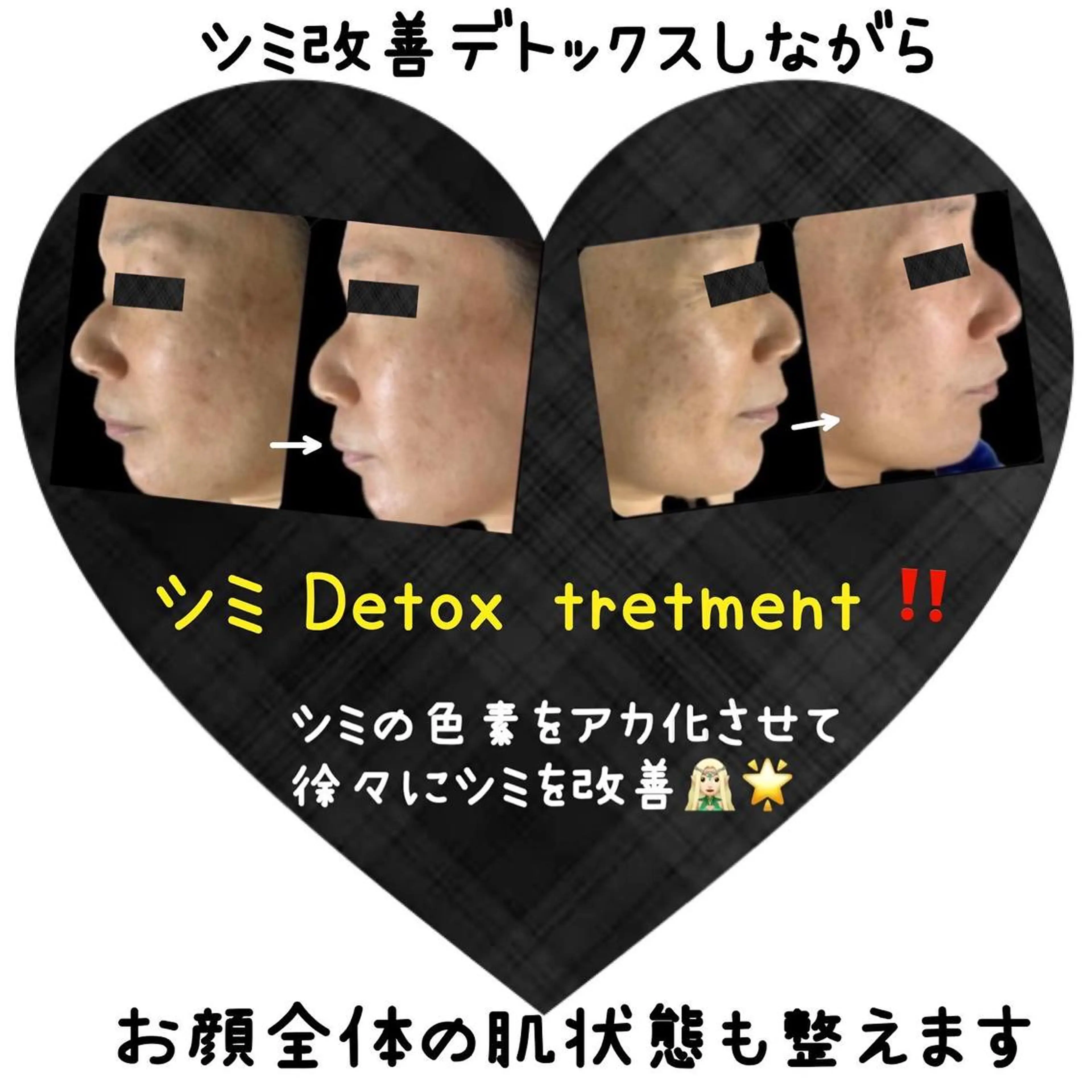 エステ ヴィーナス ビューティーのエステ・リラクイメージ