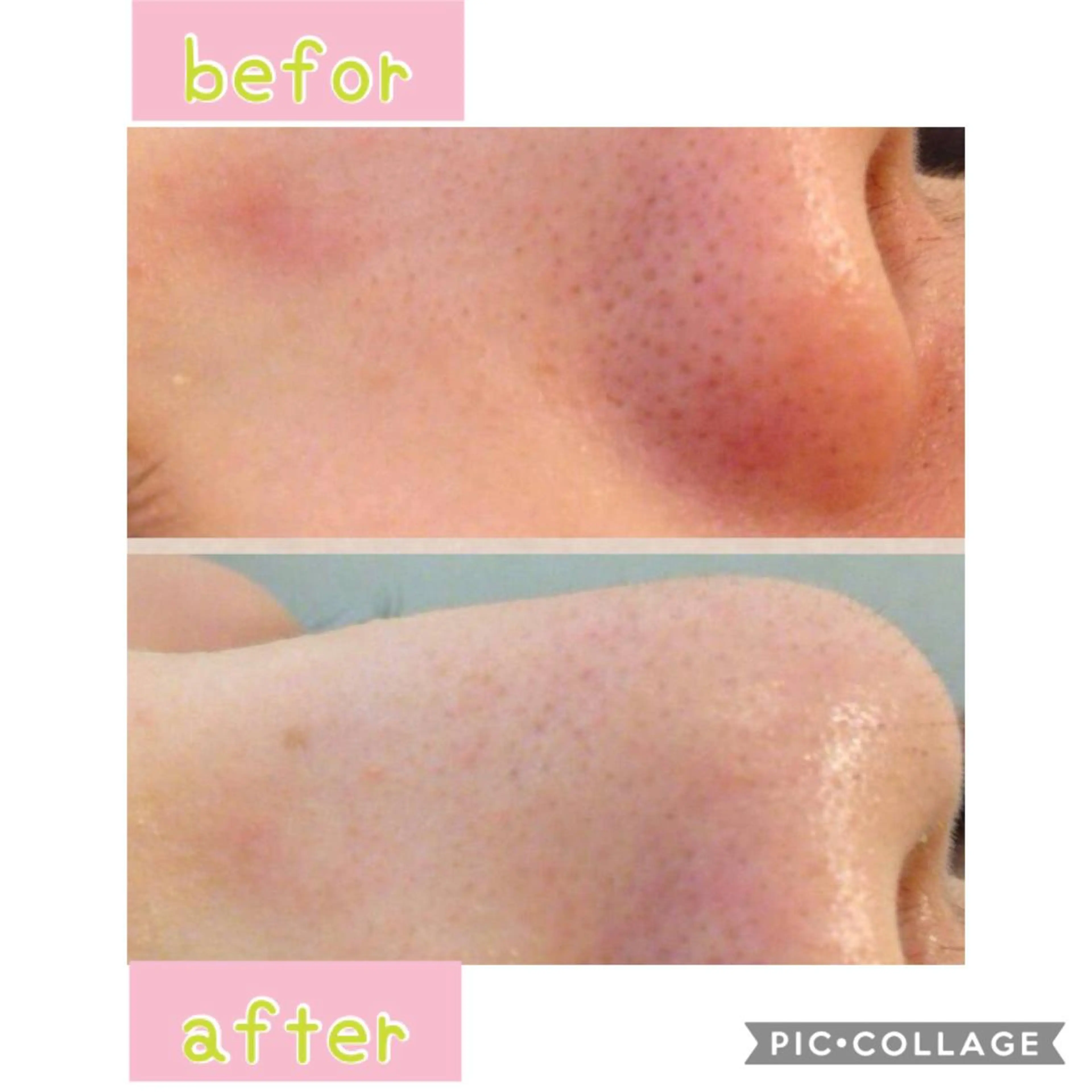 癒し腸もみサロン シャユーム　ゆきなのエステ・リラクイメージ