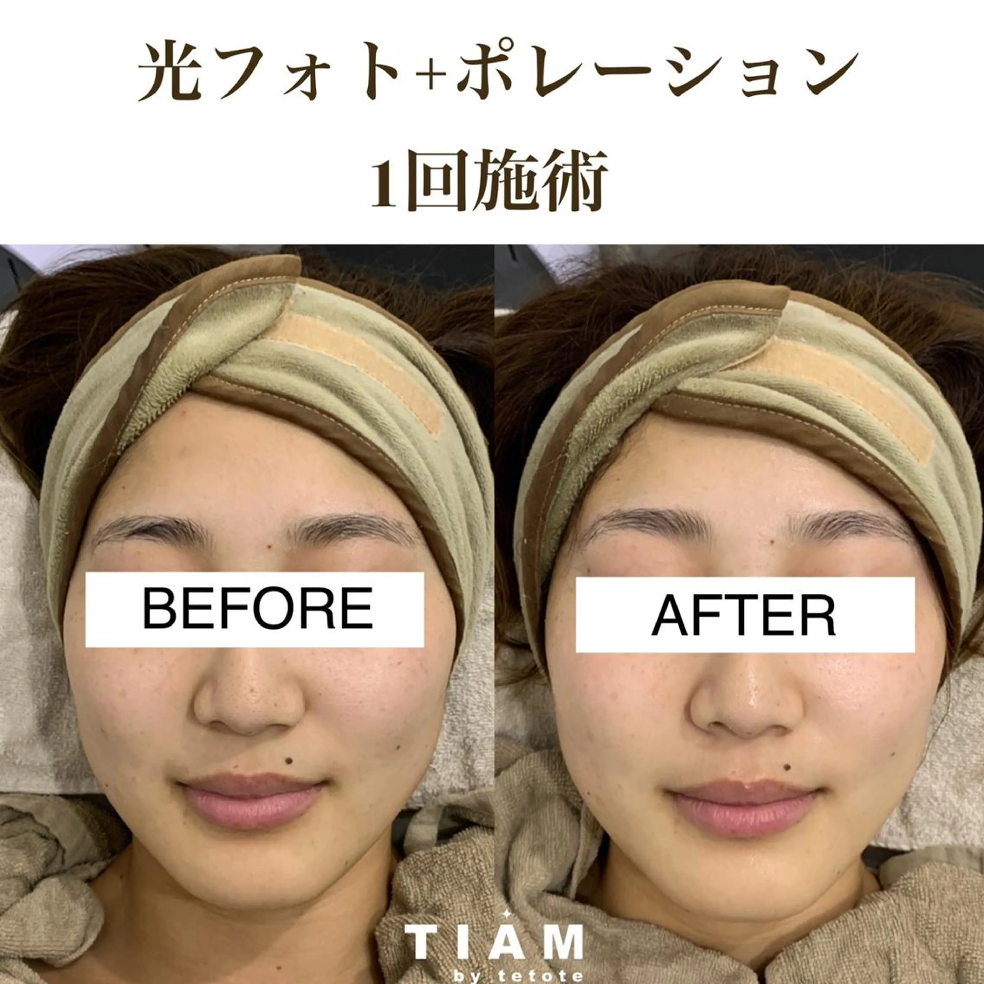 美肌サロンTIAM by tetoteのエステ・リラクイメージ