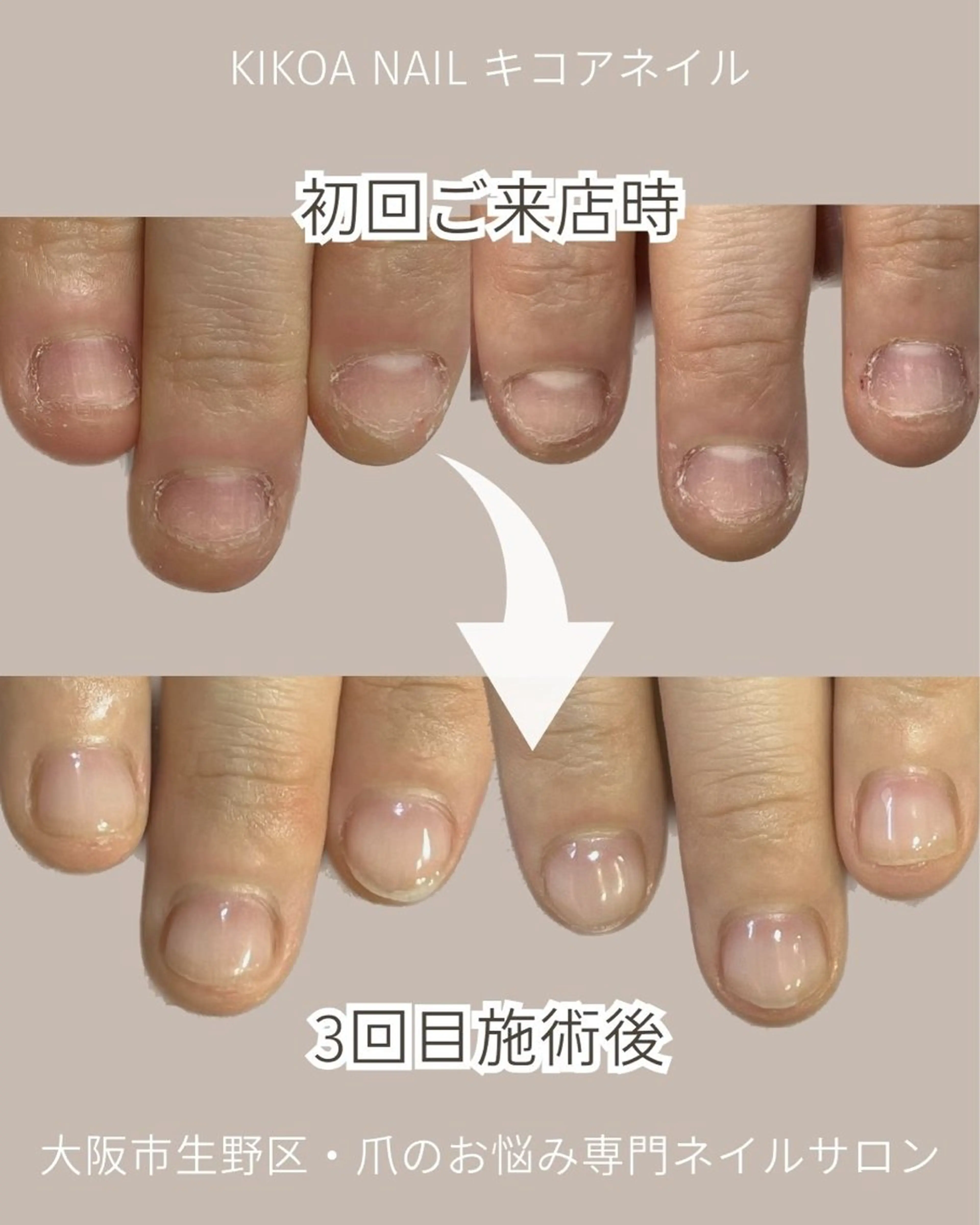 ネイル KIKOA NAIL キコアネイルのネイルデザイン