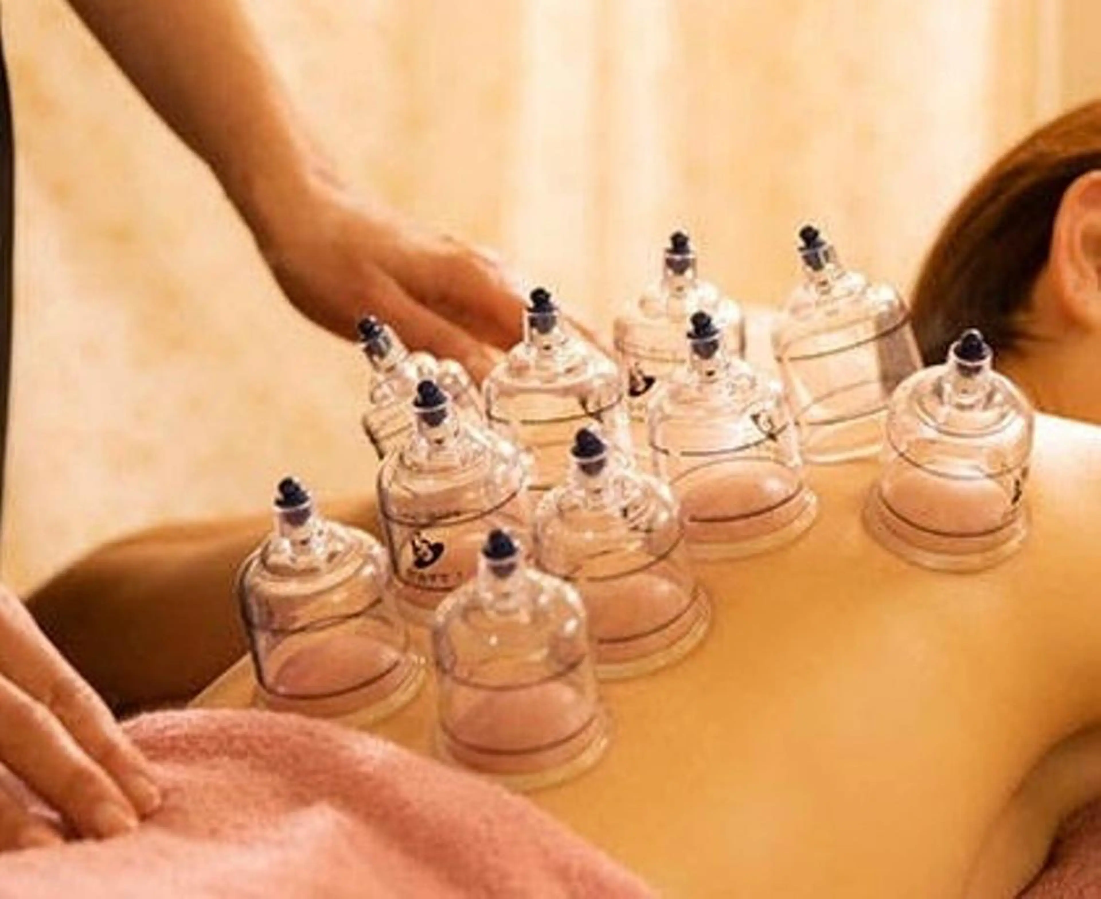 [初回クーポン]韓国式カッピングの写真