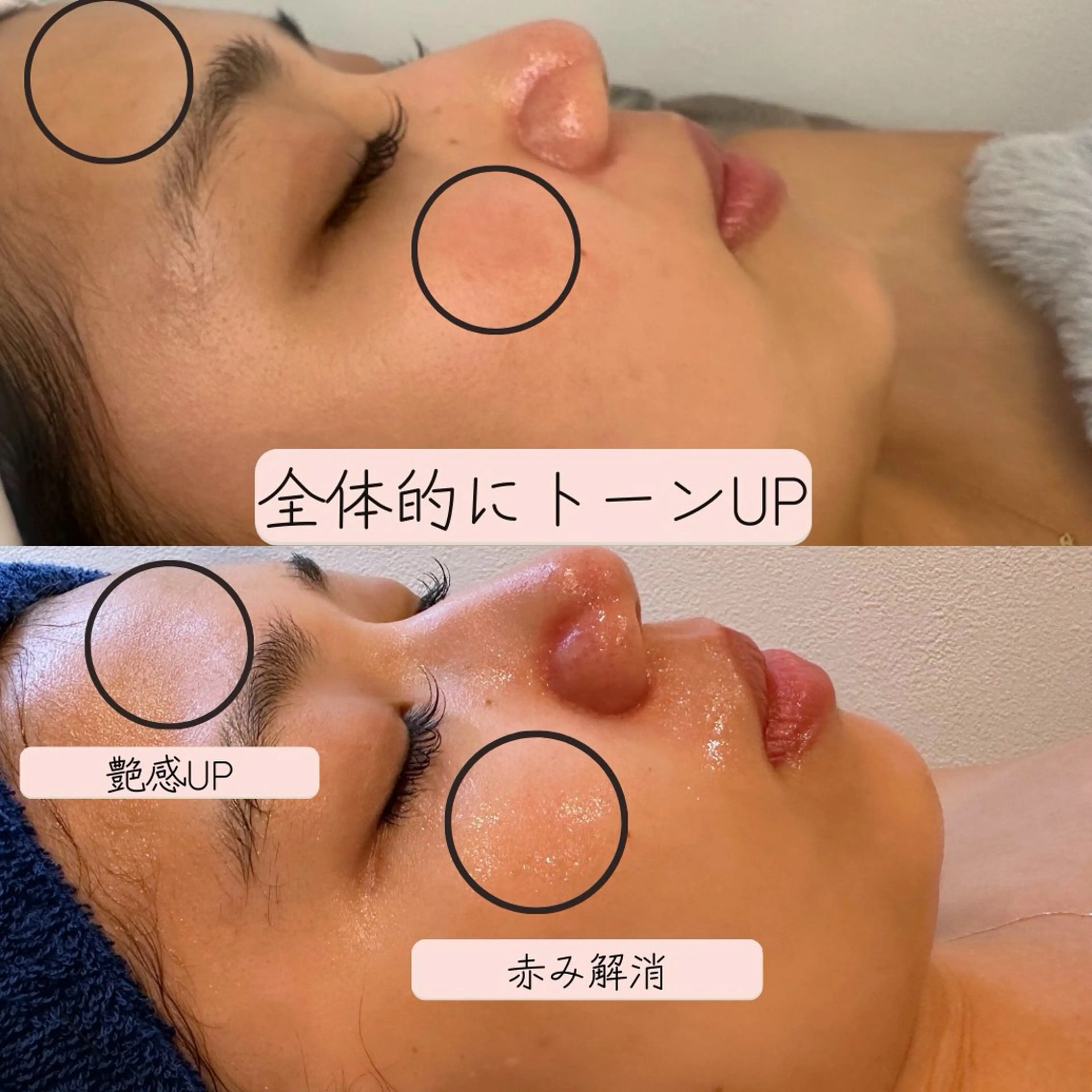 エステ THE  PEACH スタッフのエステ・リラクイメージ