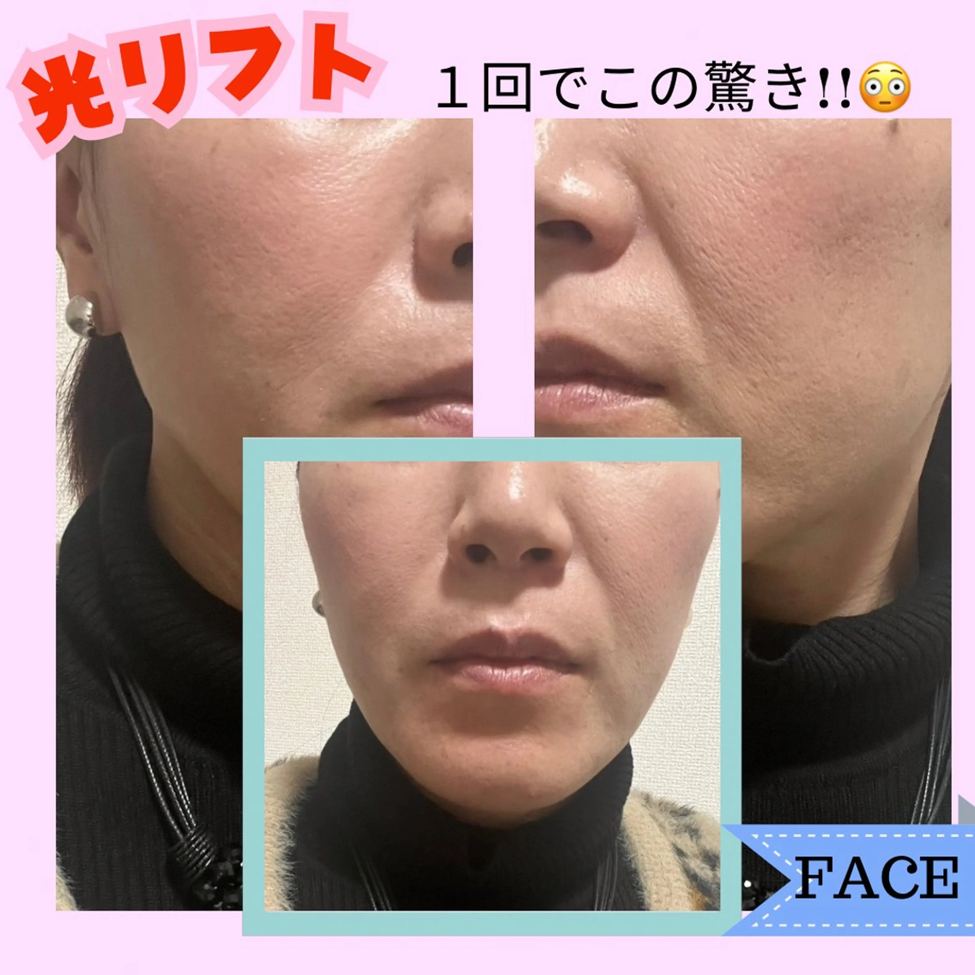 Adam 上半身美人のエステ・リラクイメージ