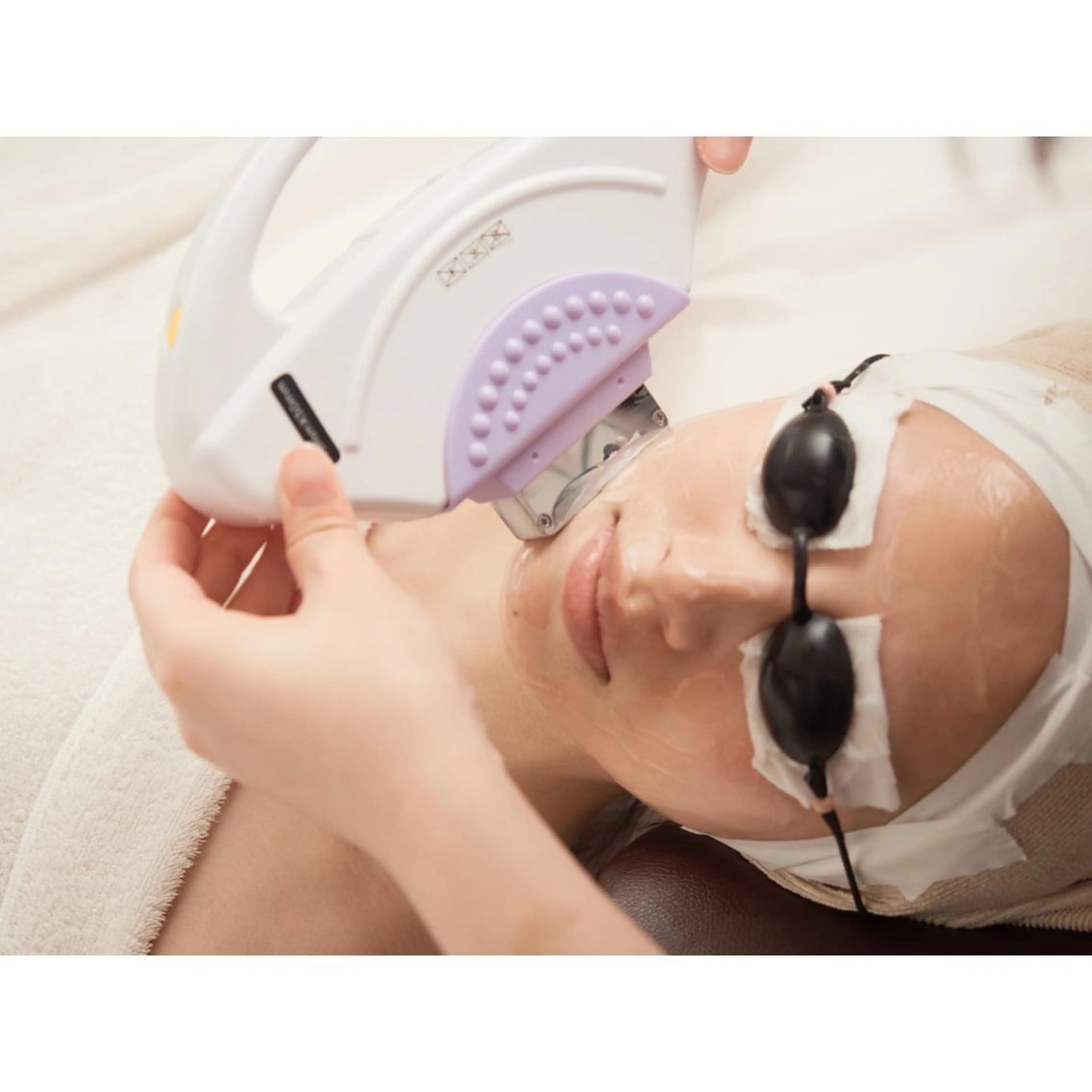 レディース顔脱毛の写真