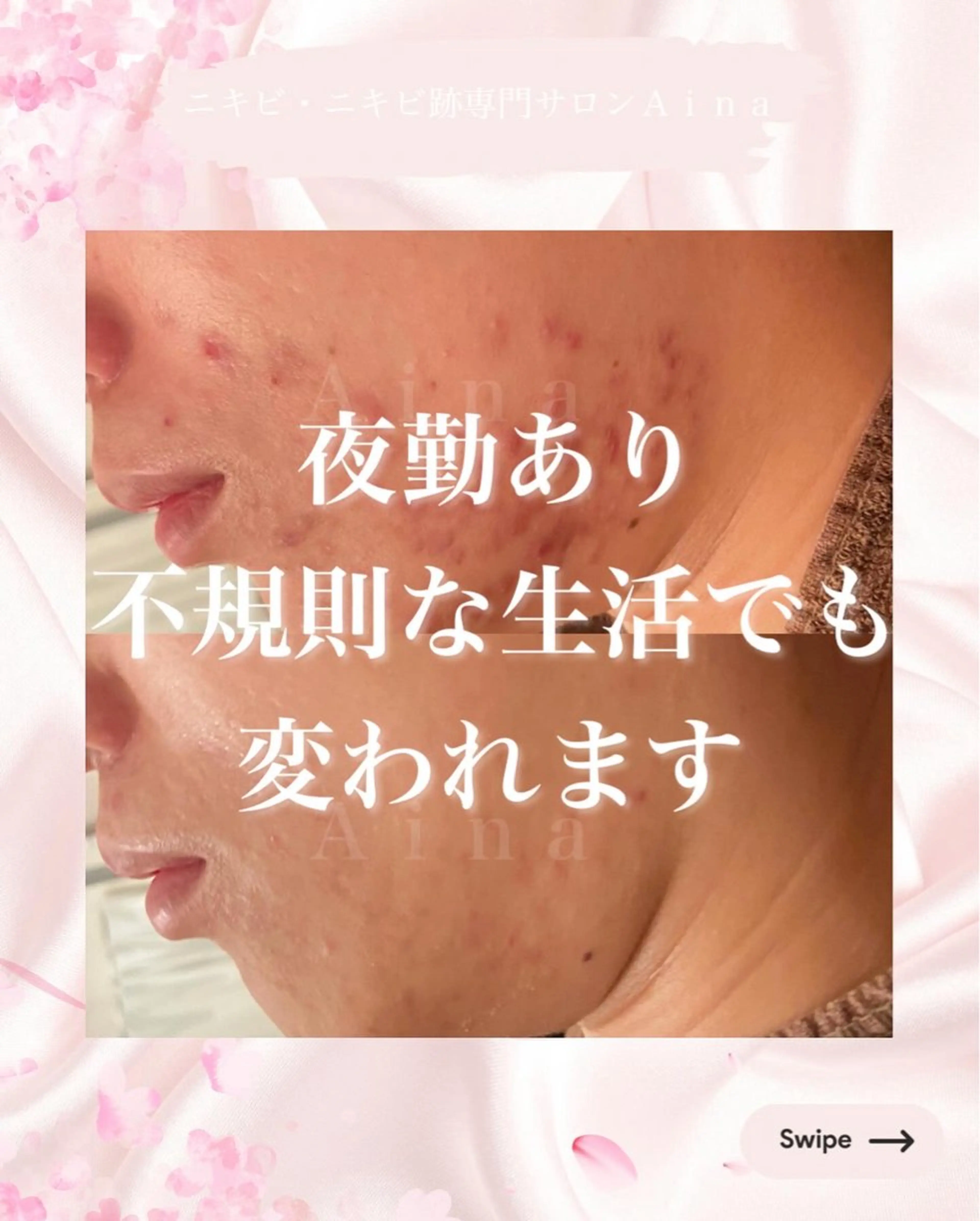 エステ リラク ニキビ跡専門サロン Ａｉｎａのエステ・リラクイメージ