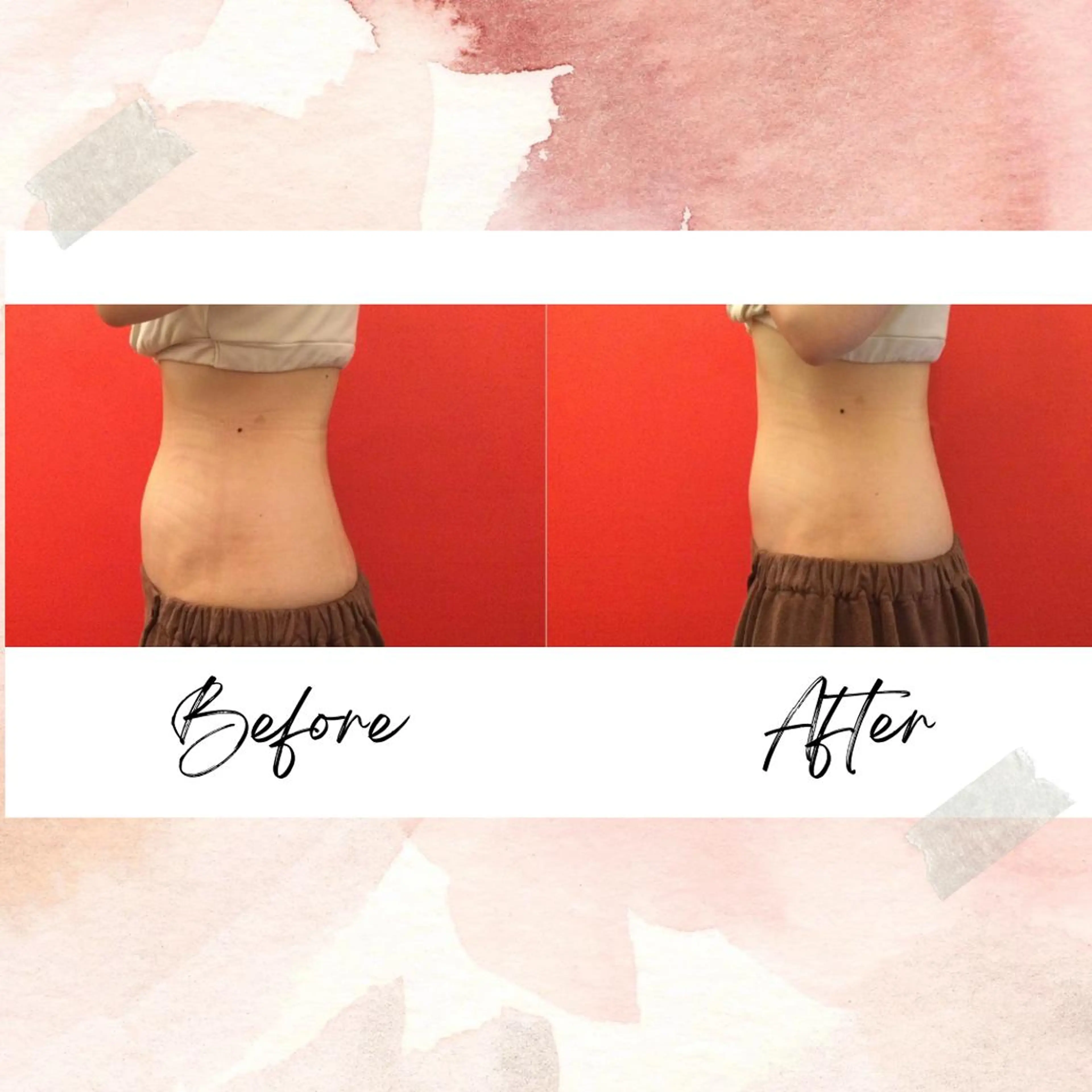 【ダイエット/ポッコリお腹に🙉】美腸マッサージ40分＋蒸気温熱10分\8,000の写真