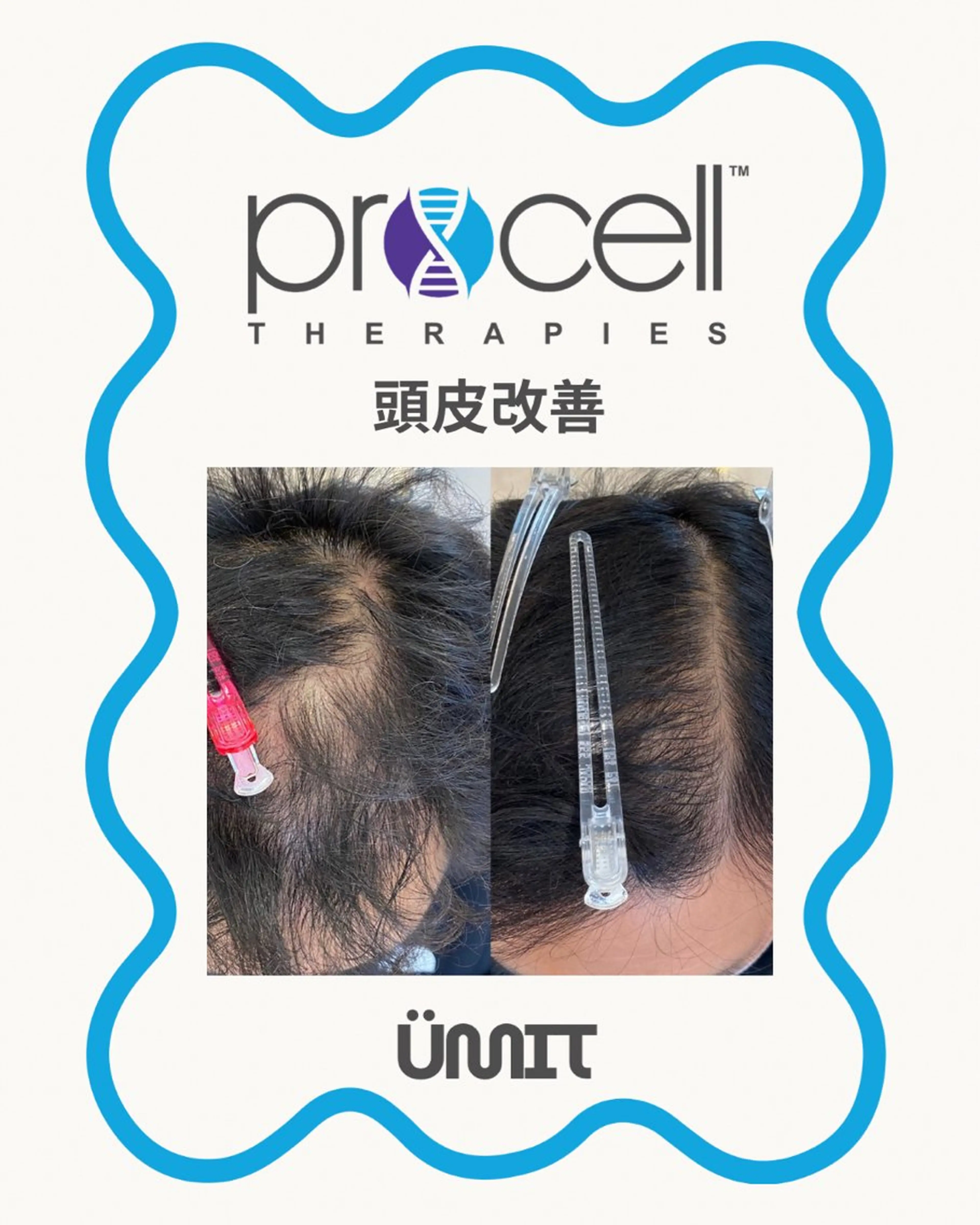 メンズ ヘッドスパ Ümit（ユミト） プロセルセラピーズのヘアスタイル