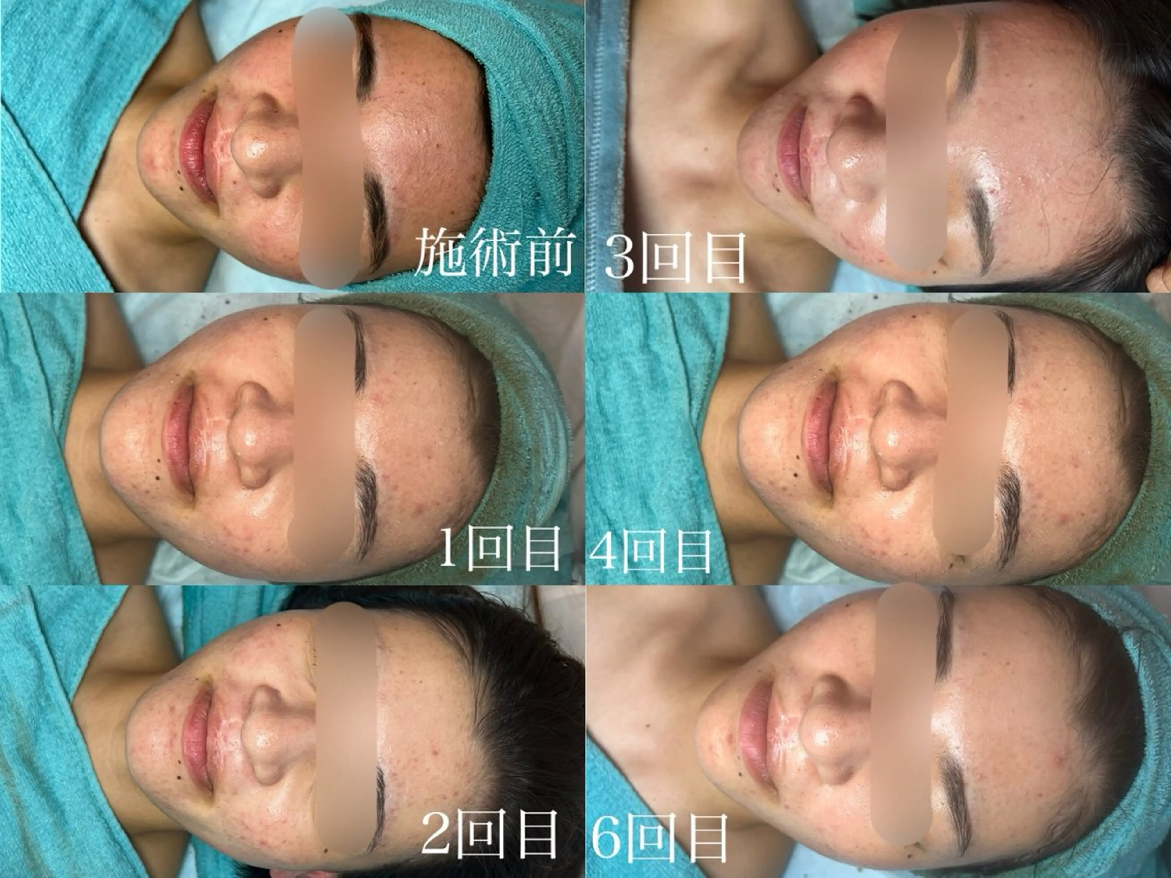 潤い艶肌／肌質改善 YUKAのエステ・リラクイメージ