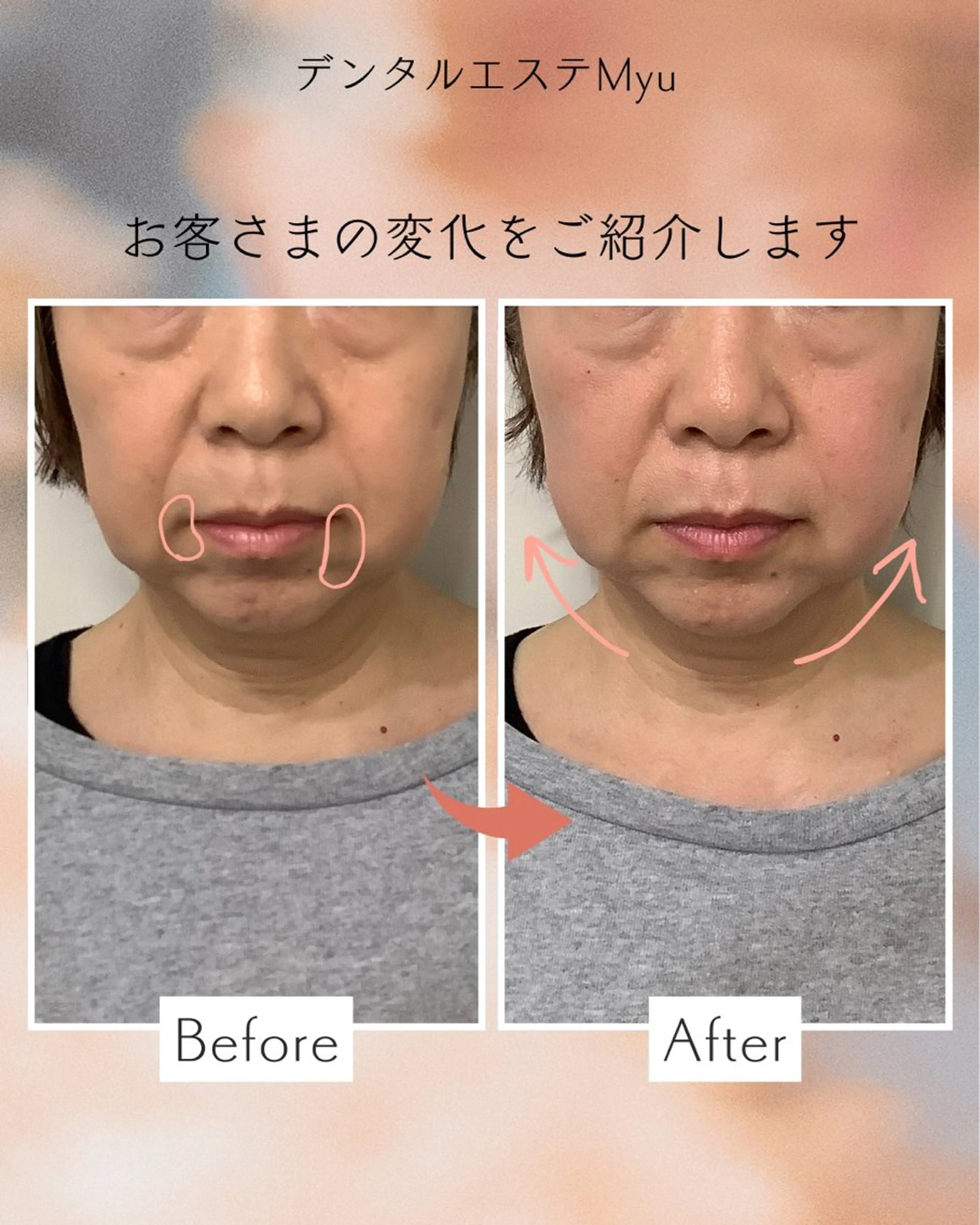 エステ Myu所属・Suzuki Yumiのエステ・リラクイメージ