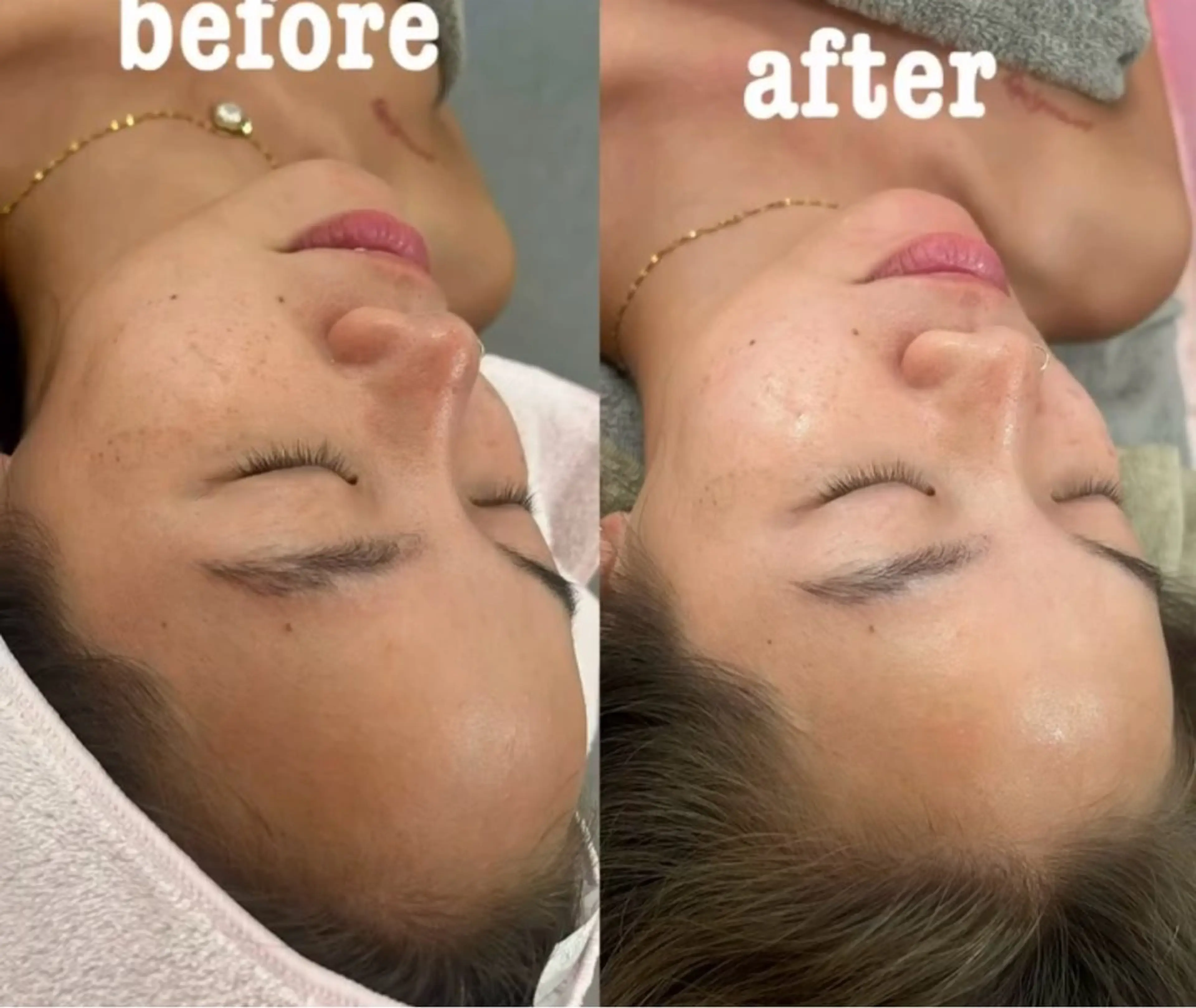 エステ リラク 美容鍼灸サロン mahoroba院長のエステ・リラクイメージ