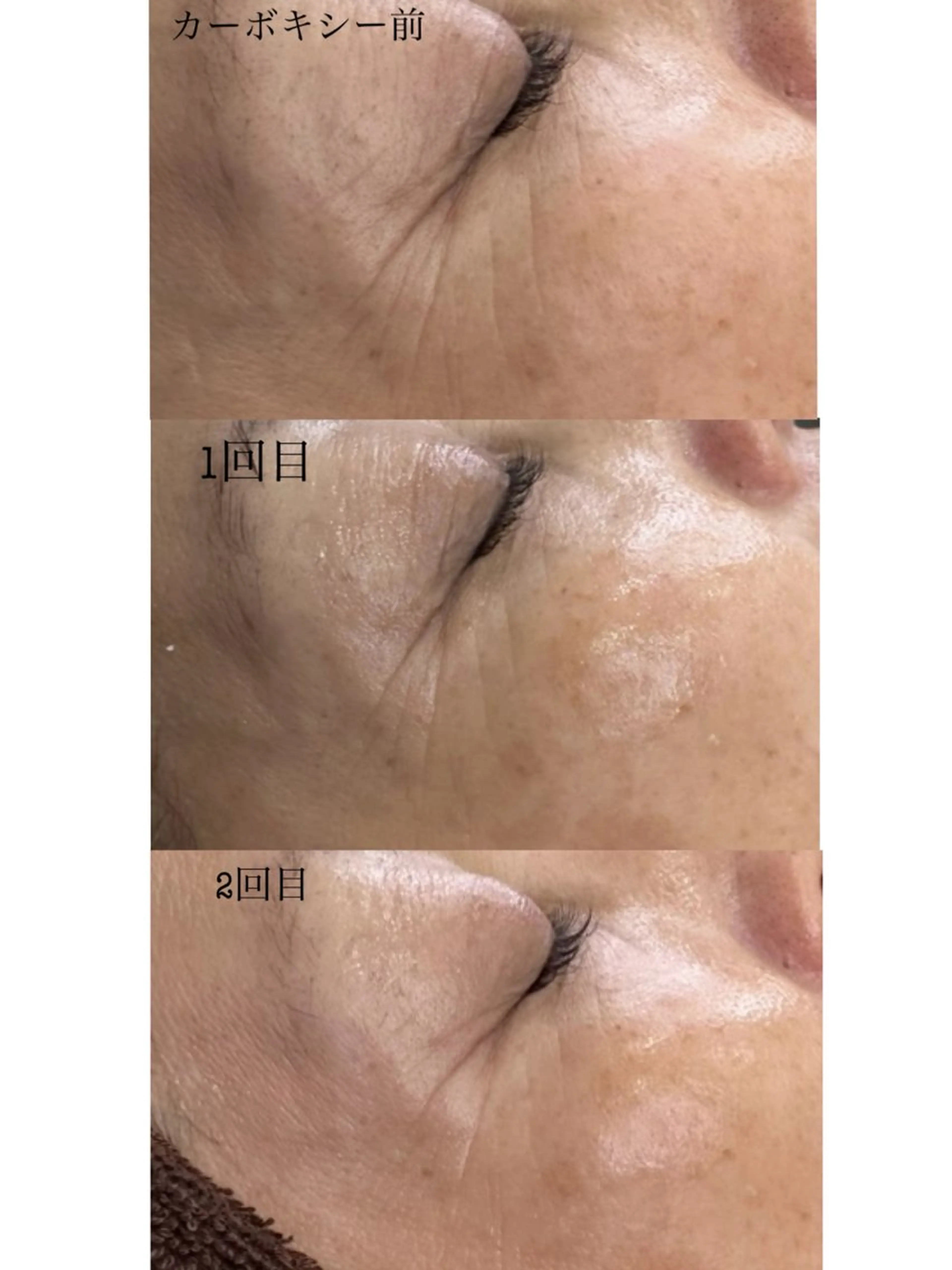 BIREINA Eyelash  Salon所属・BIREINA 住之江公園のマツエク・マツパデザイン