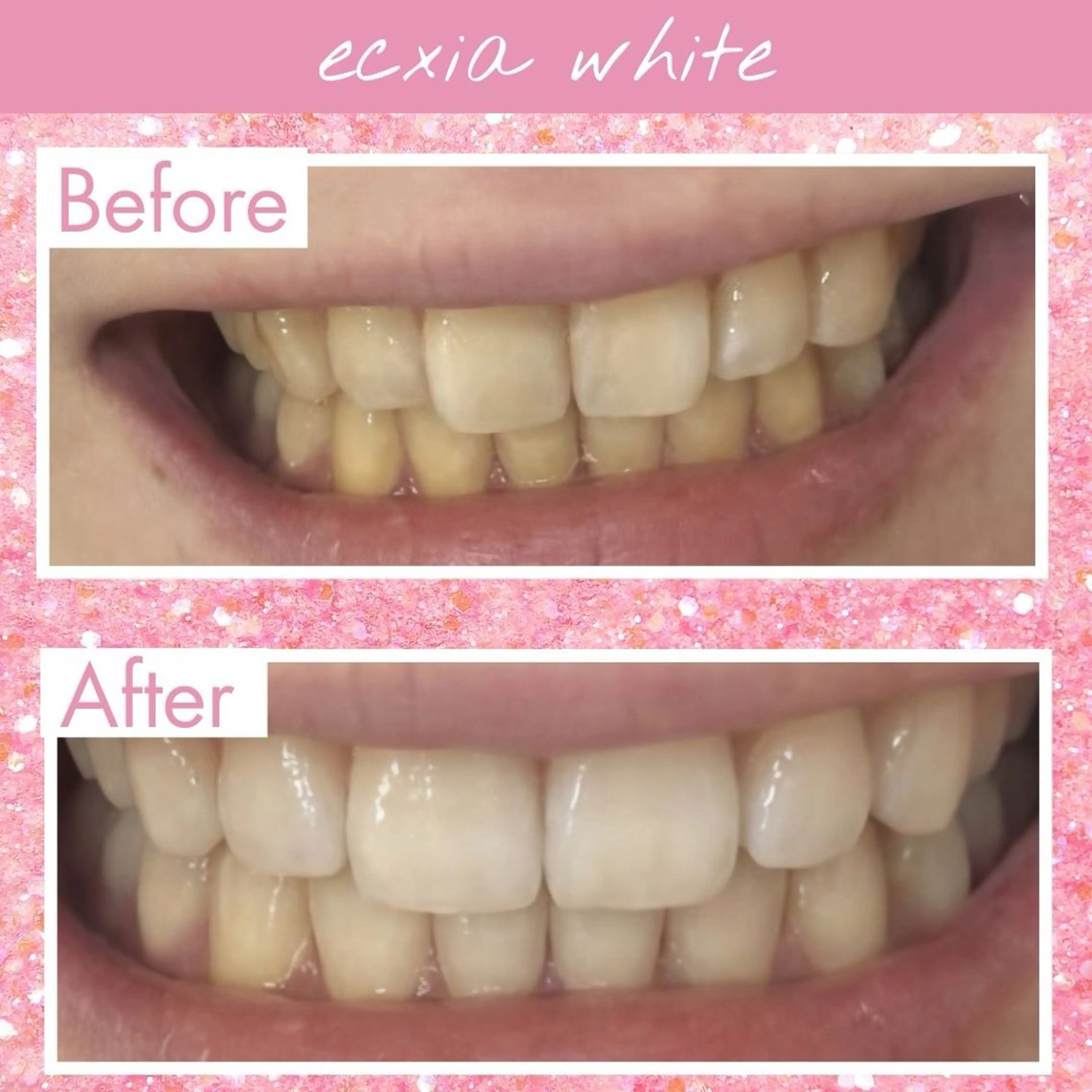 その他 セルフホワイトニング エクシア大府店のその他イメージ