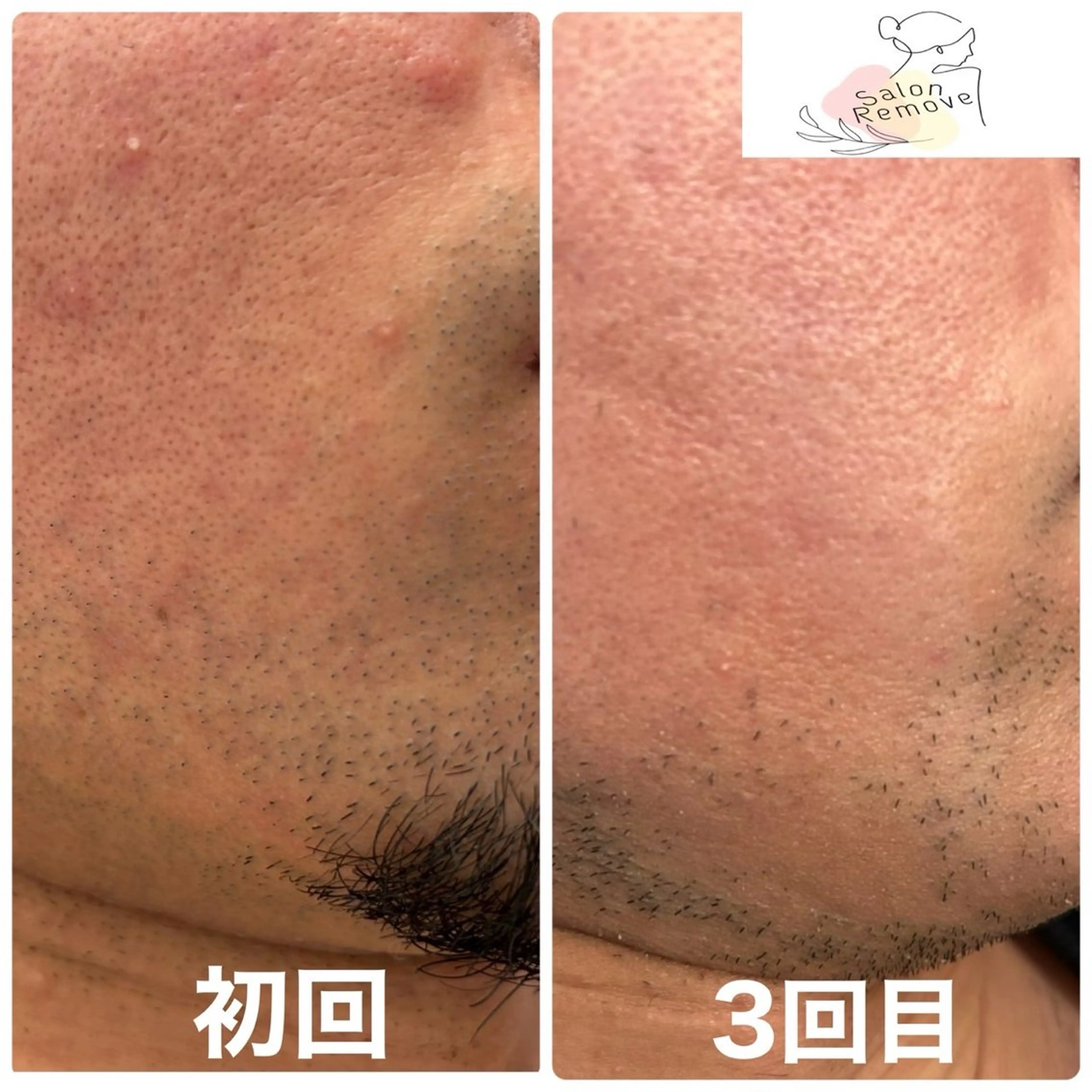 salon Removeのエステ・リラクイメージ