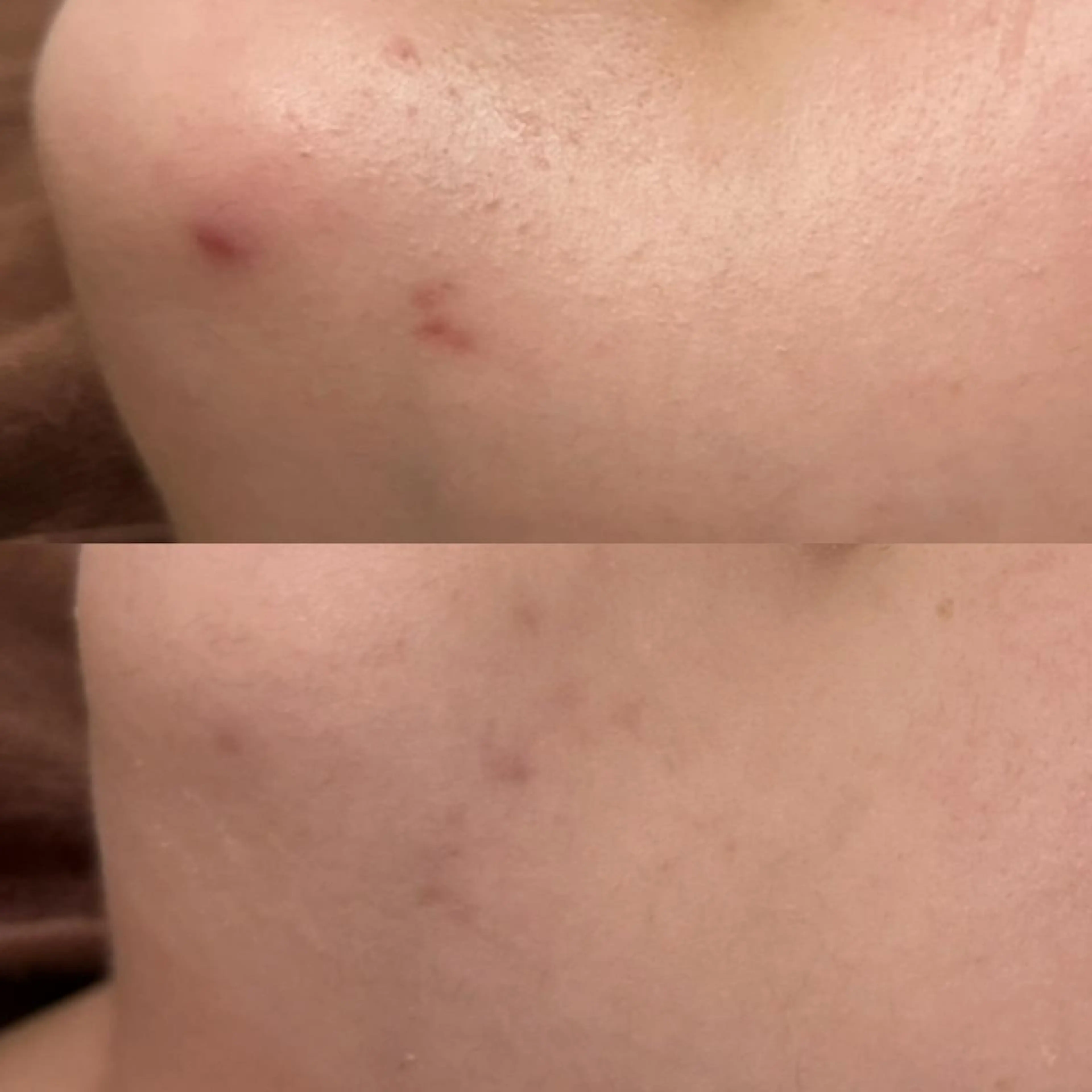 3か月で肌革命👼 ニキビ専門店💫のエステ・リラクイメージ