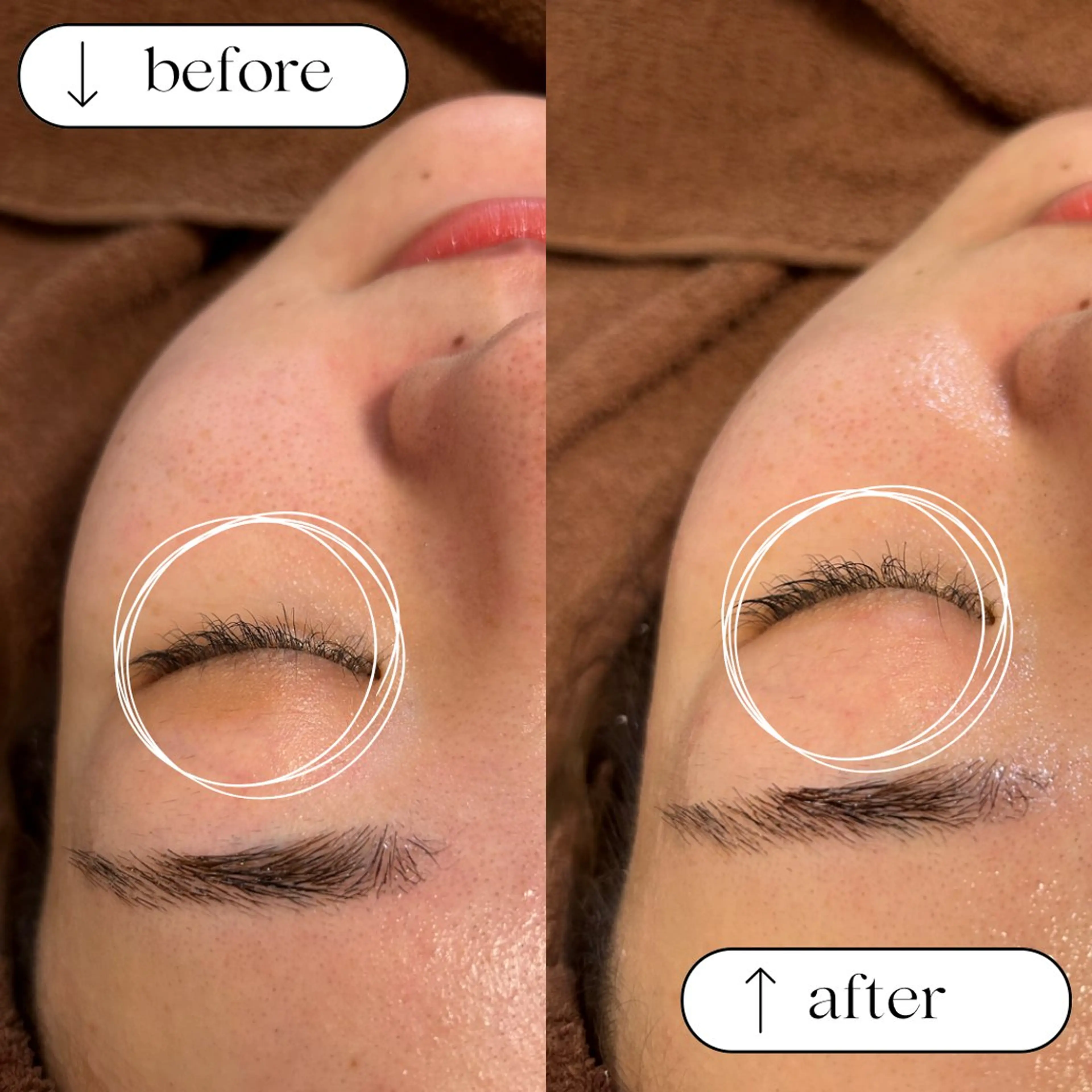 【高濃度スペシャルケア✨】あらゆる肌トラブルに対応！ヒト幹細胞でお悩み解決💆🏼💆🏼‍♀️ヒト幹細胞パックの写真