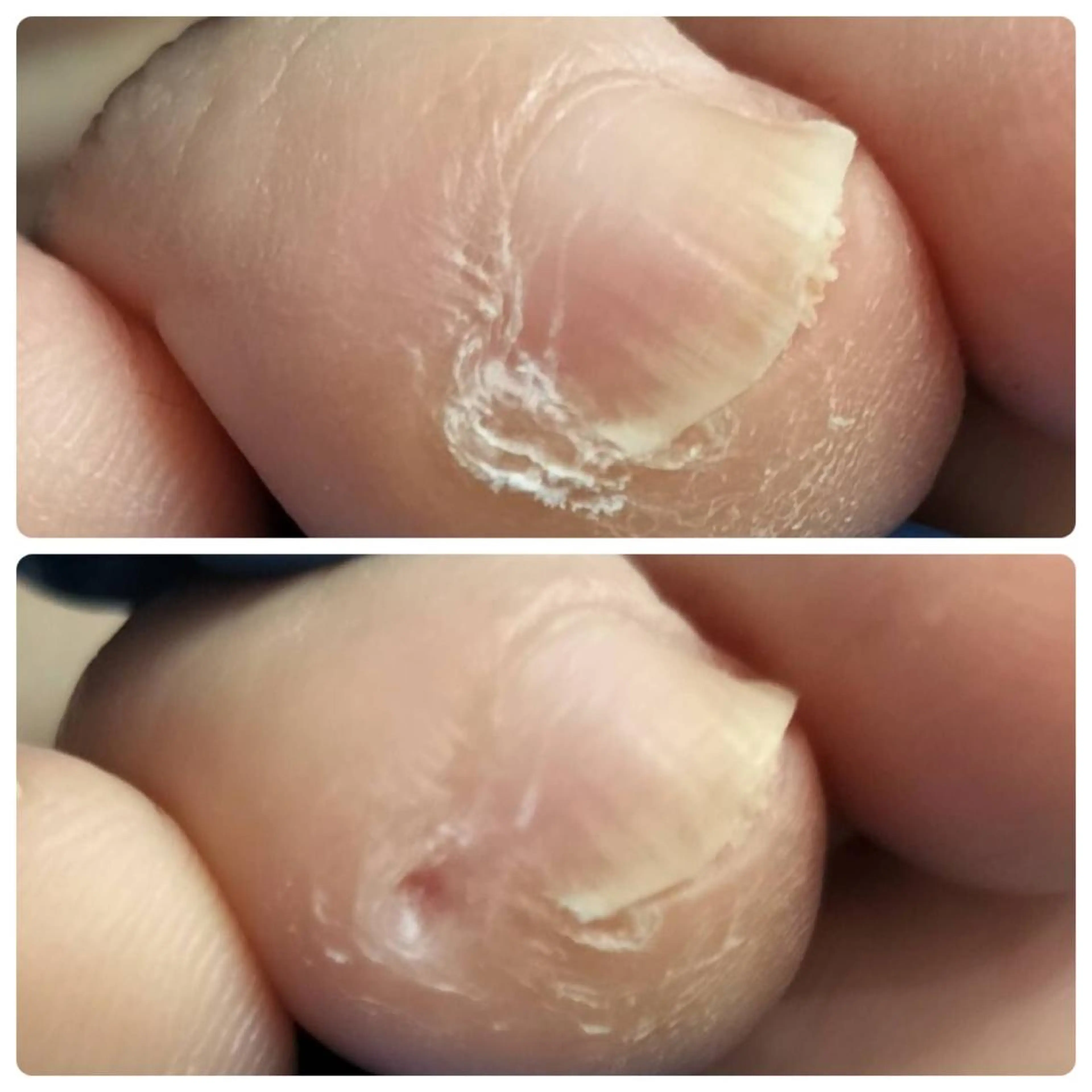 その他(ネイル) e.nail所属・和賀井 恵理のネイルデザイン