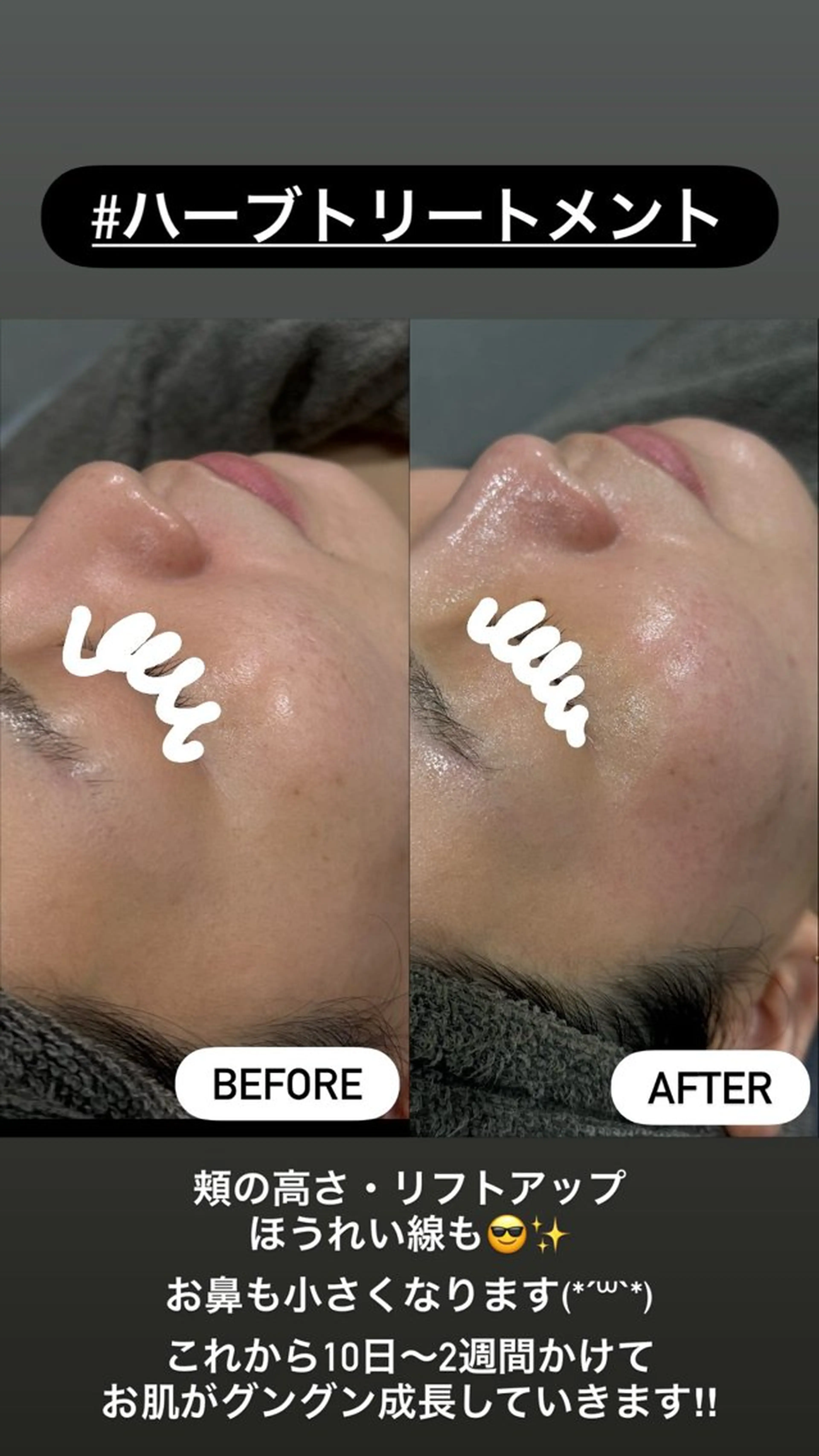 エステ LiZA エステティックサロンのエステ・リラクイメージ