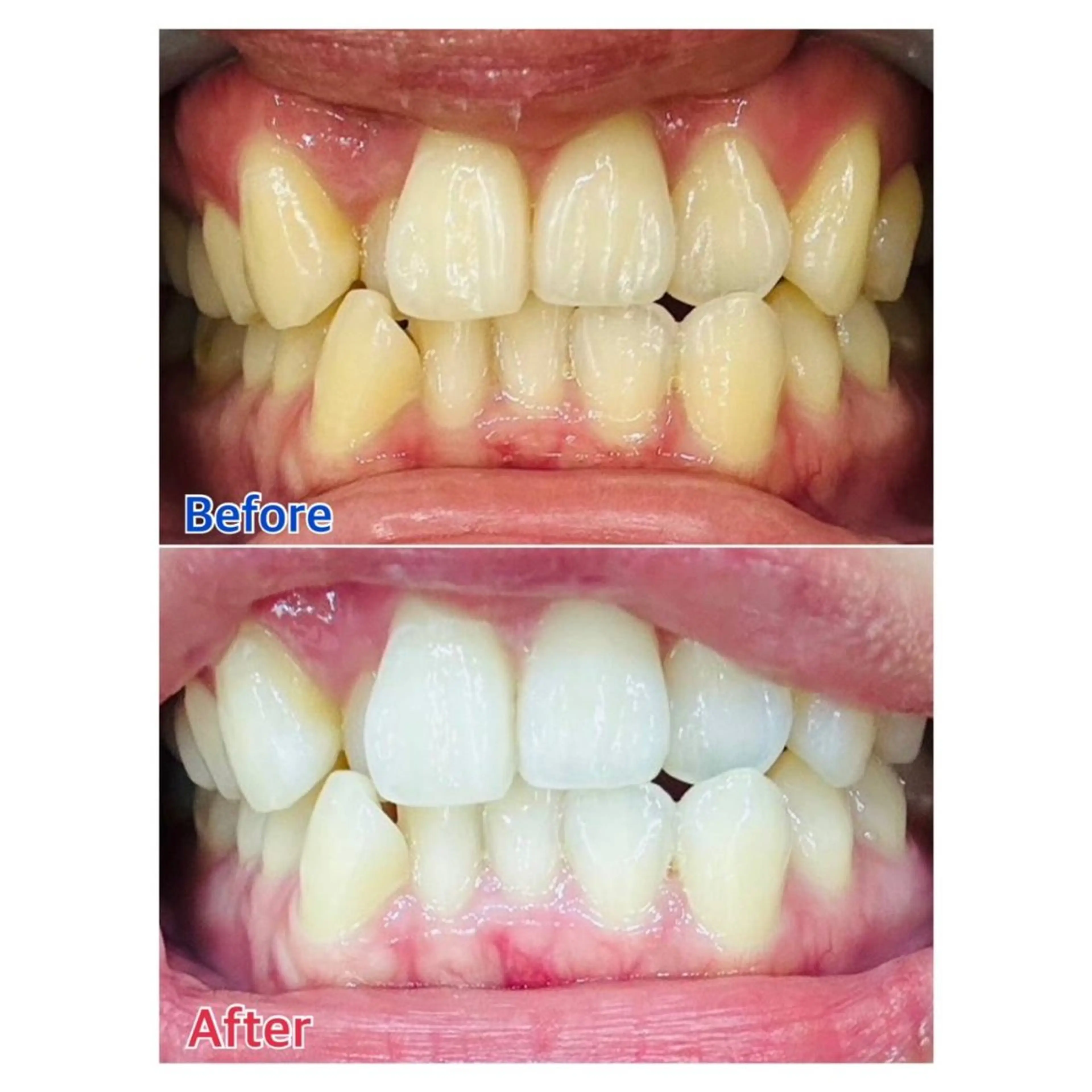 MBEAUTYSALON 千葉店・京成大久保所属・Melty 輝のその他イメージ