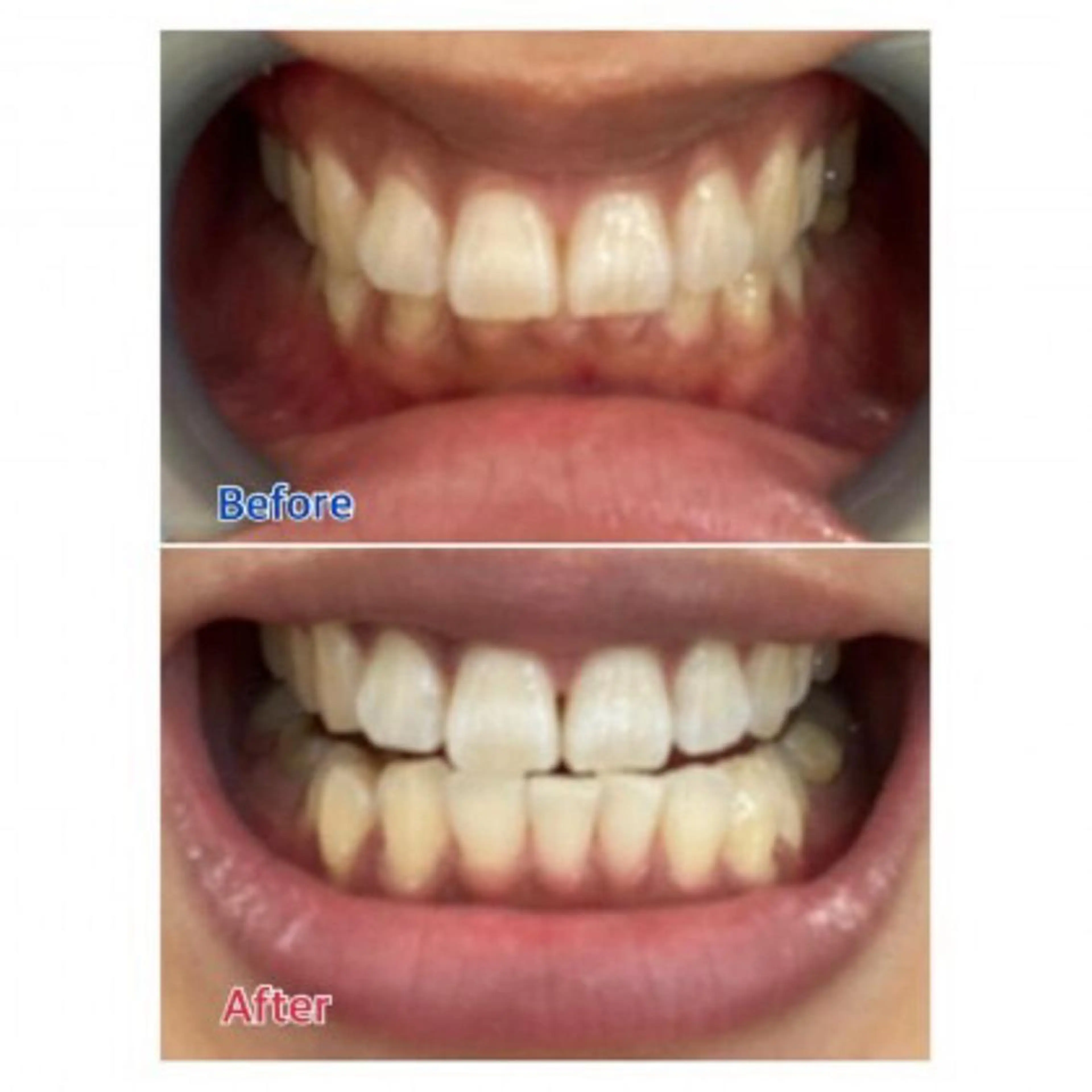 M渋谷店所属・Ｍ渋谷 ホワイトニングのエステ・リラクイメージ